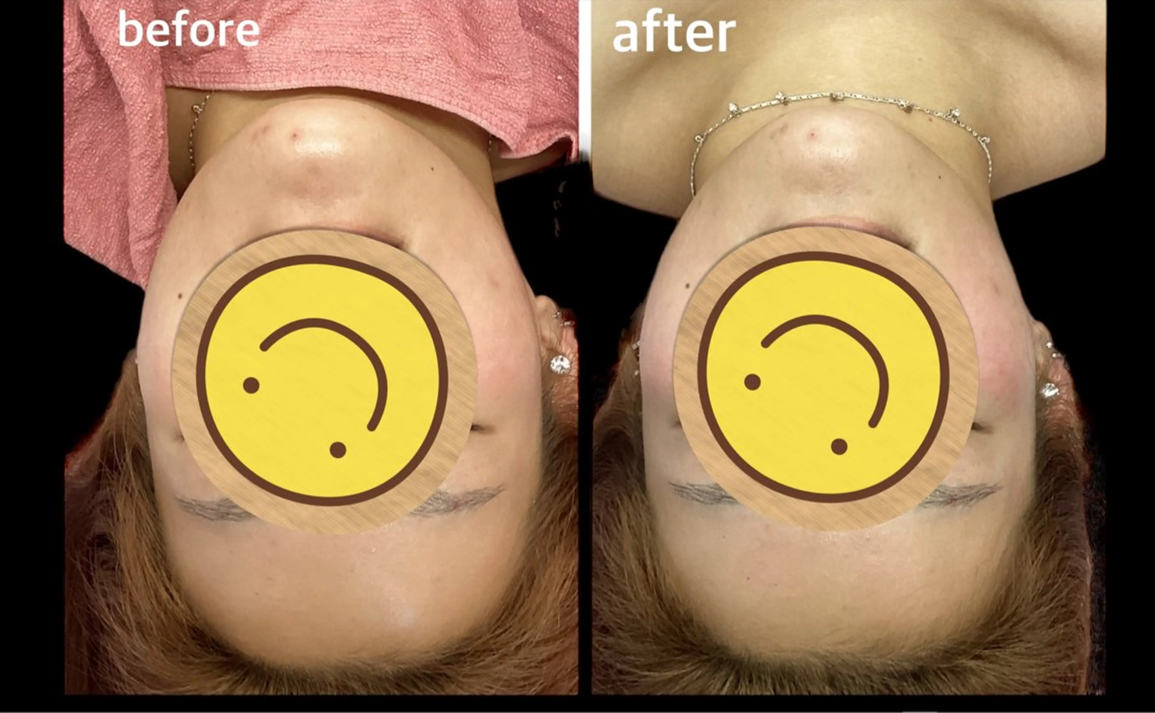 アジア大会ファイナリストが施術する【小顔美顔矯正】の写真