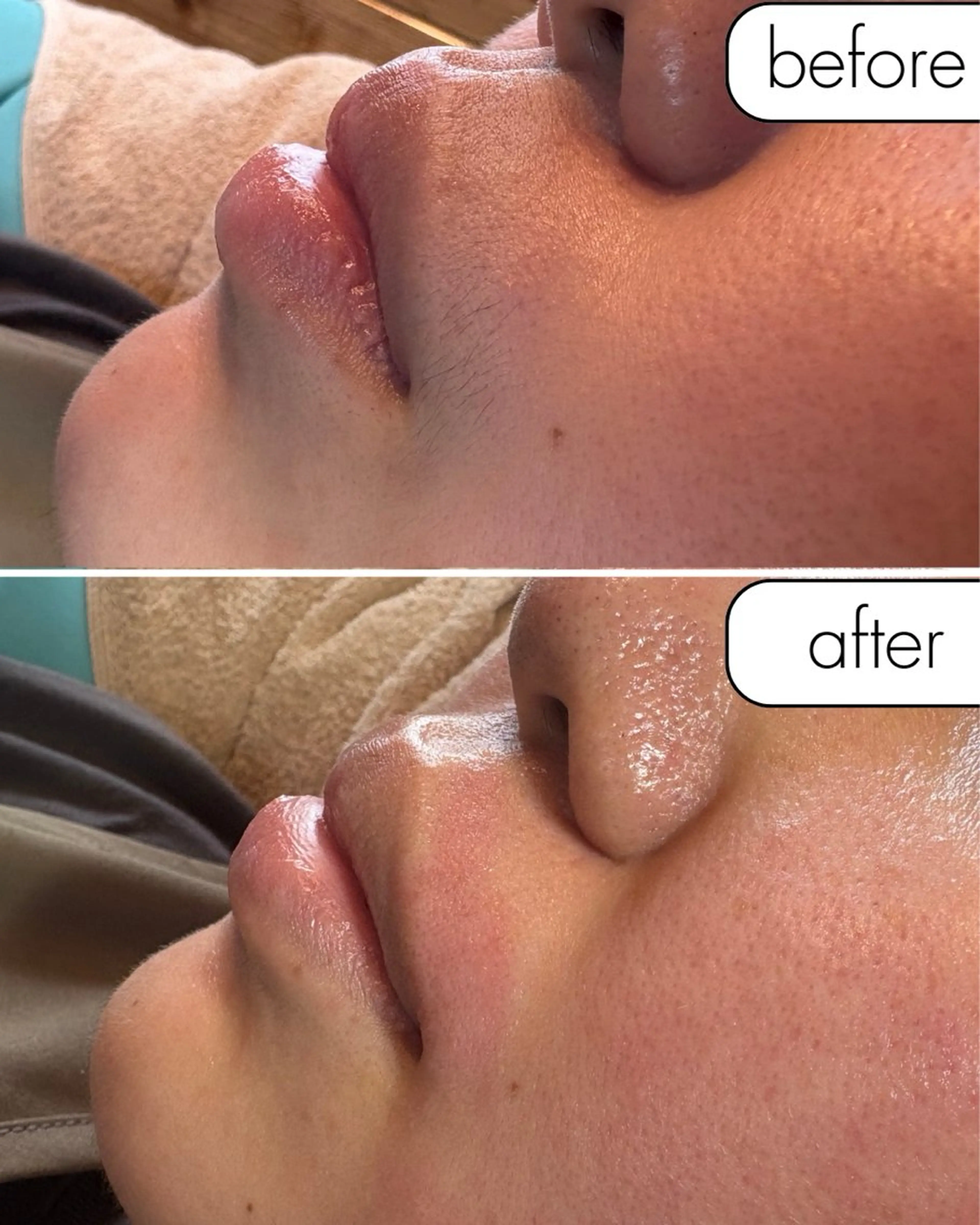 脱毛 蝶式糸除毛専門salon aco所属・糸除毛専門salon acoのエステ・リラクイメージ