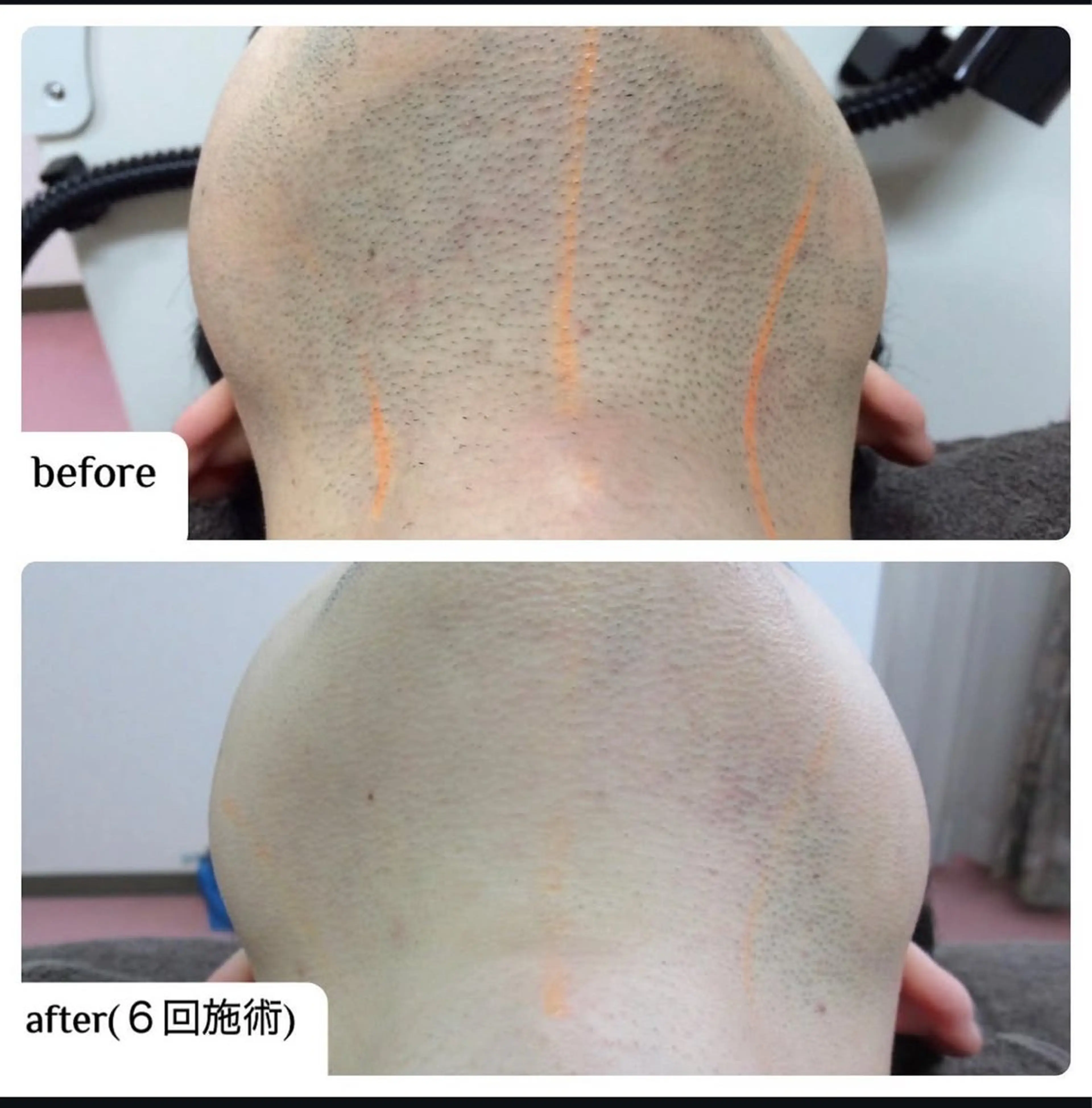 メンズ ☀️Akala☀️ メンズ脱毛のエステ・リラクイメージ