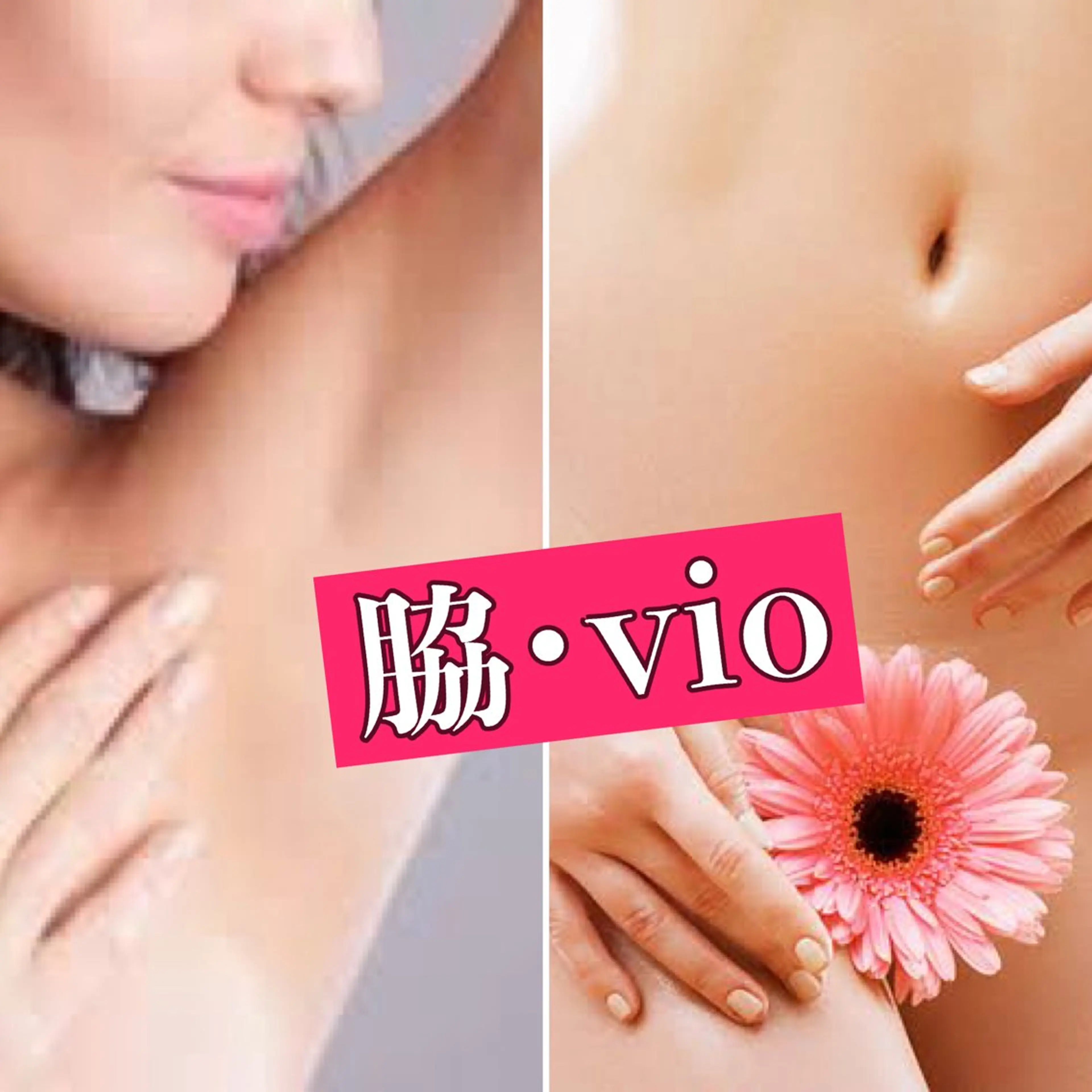 【女性限定】脇＋VIO脱毛の写真