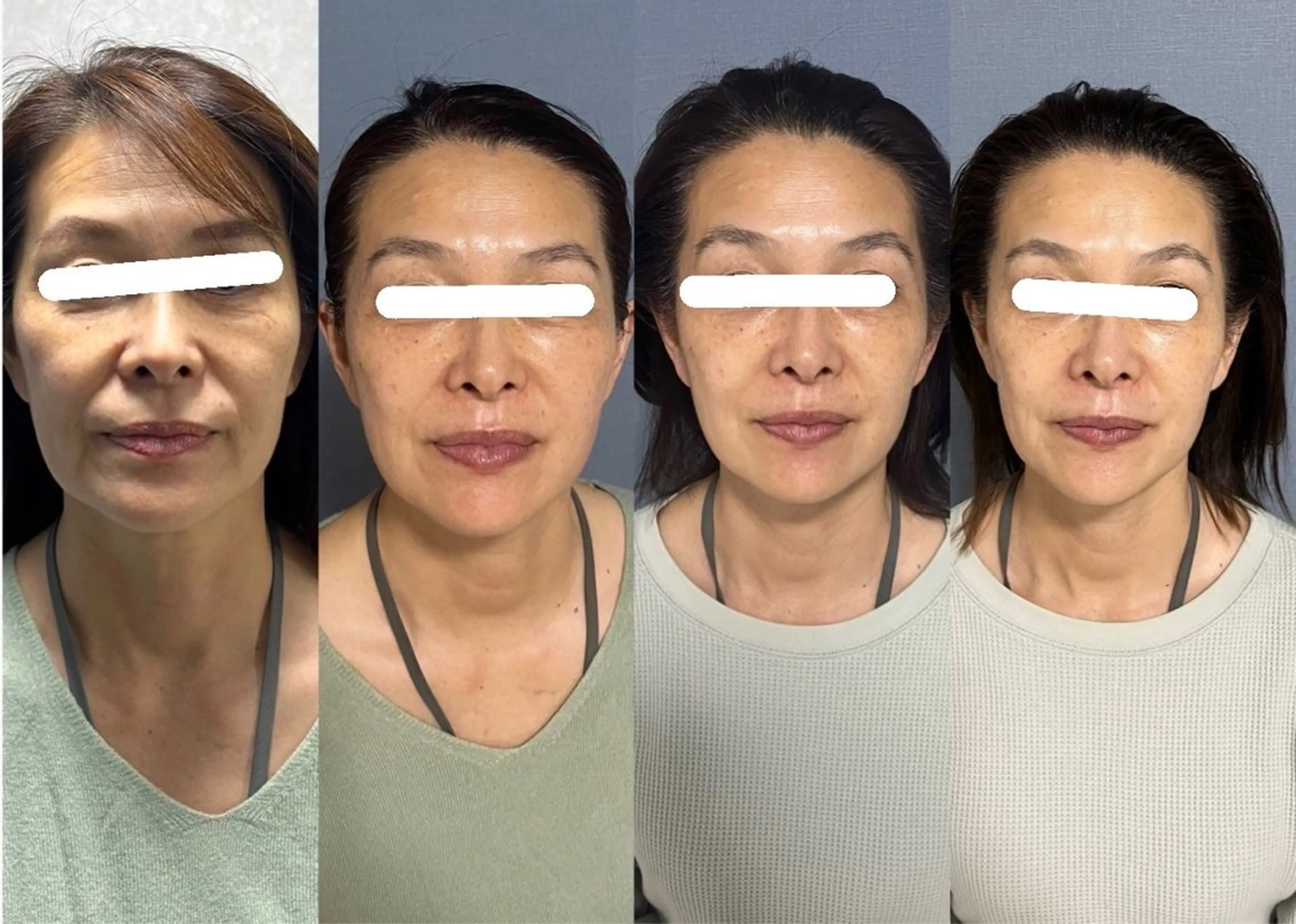 エステ Lyf salon.所属・Lyf salon.のエステ・リラクイメージ