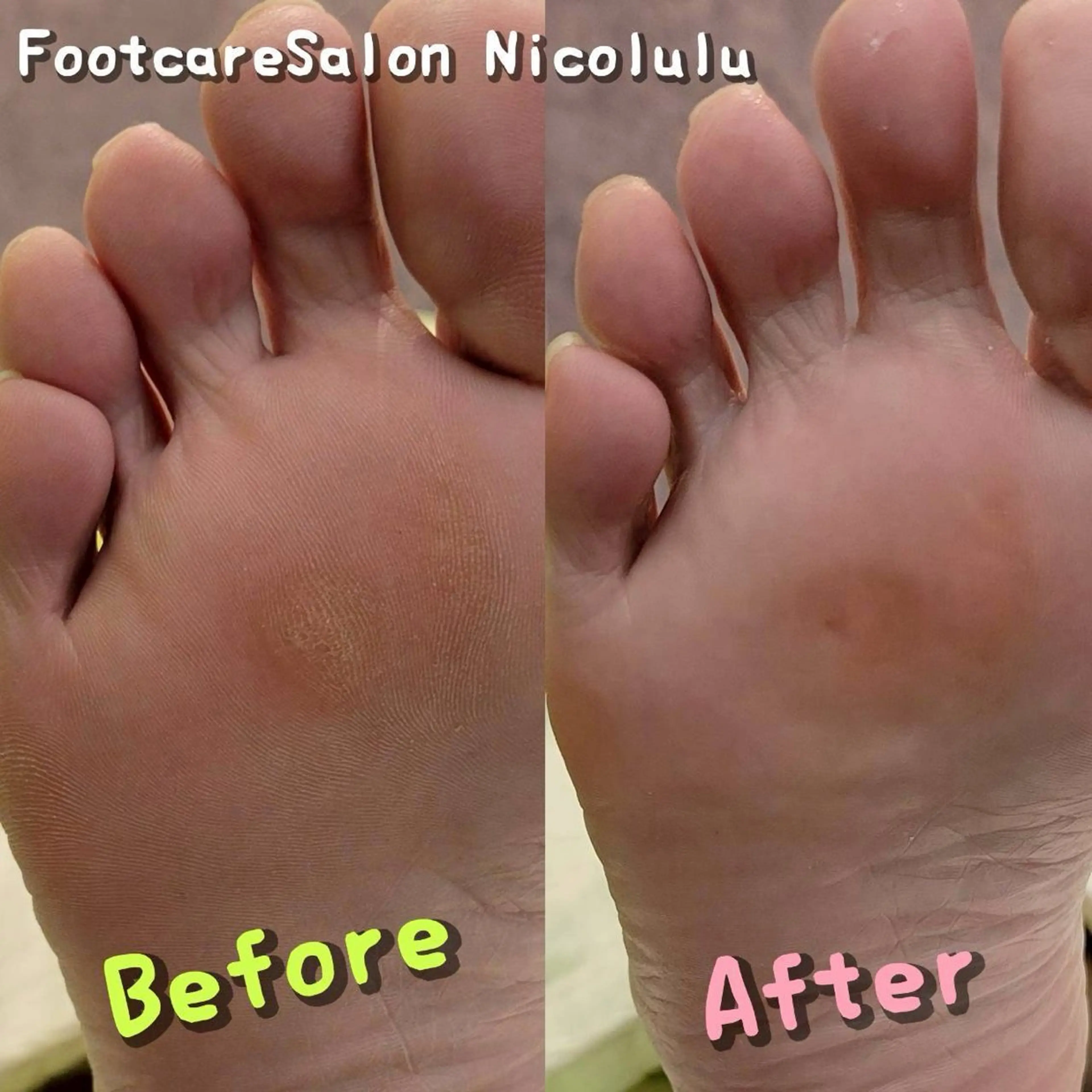 リラク 足トラブル専門 ニコルル金沢のエステ・リラクイメージ