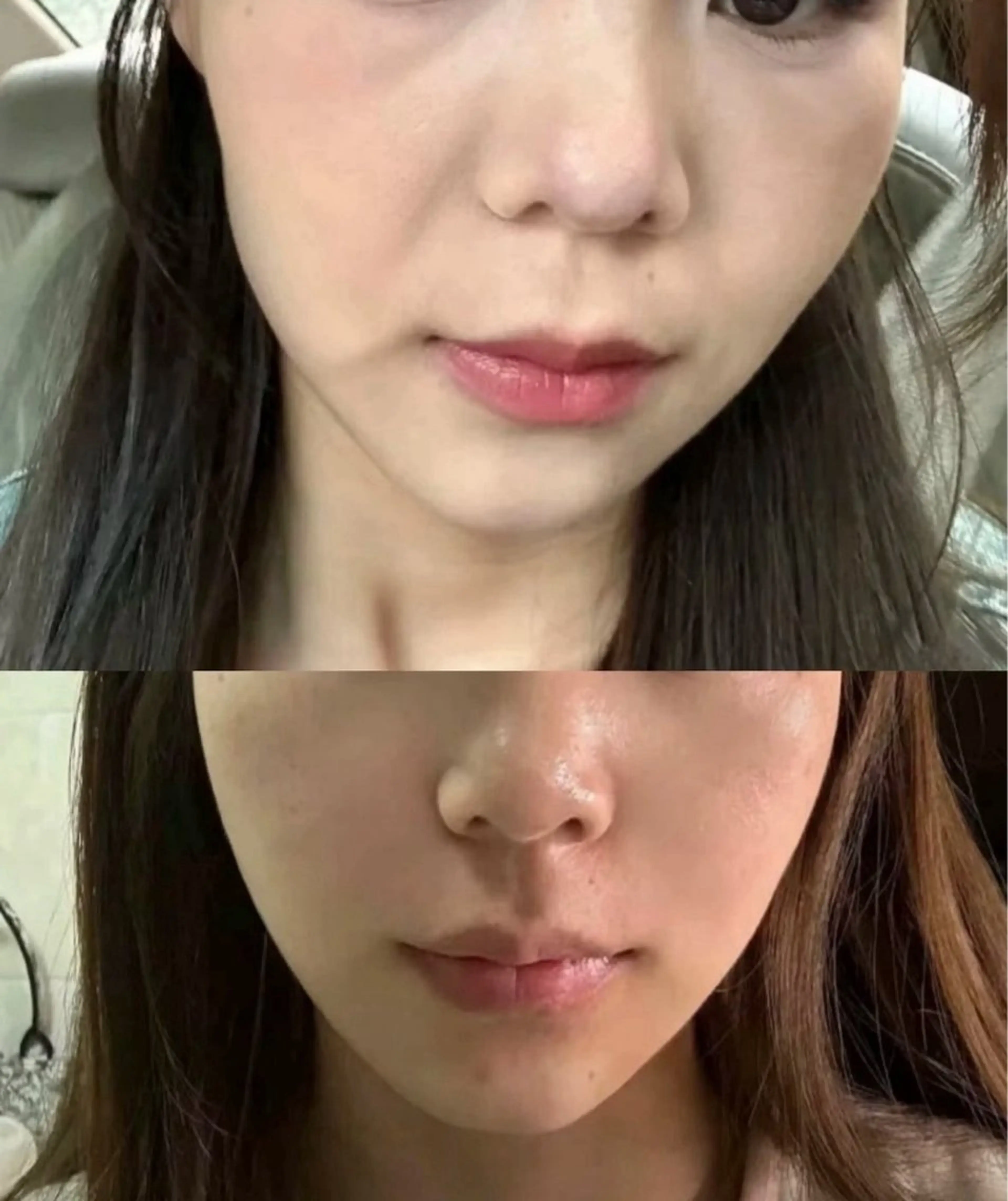 マツエク・マツパ エステ aliaハイフ&水光ジェットサロン所属・aliaハーブ水光店 エステティシャン募集のエステ・リラクイメージ