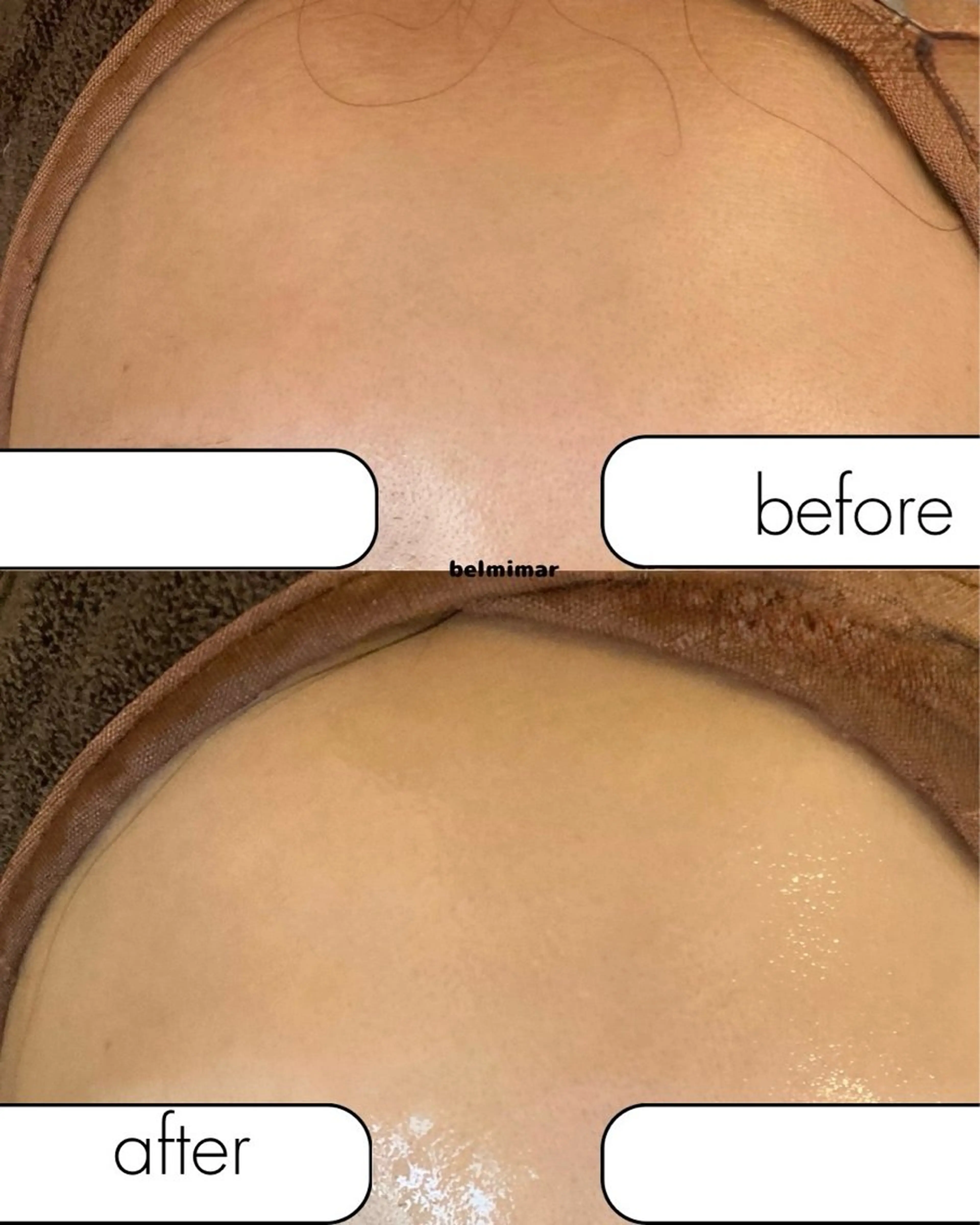 南森町・肌質改善 BELMIMARのエステ・リラクイメージ