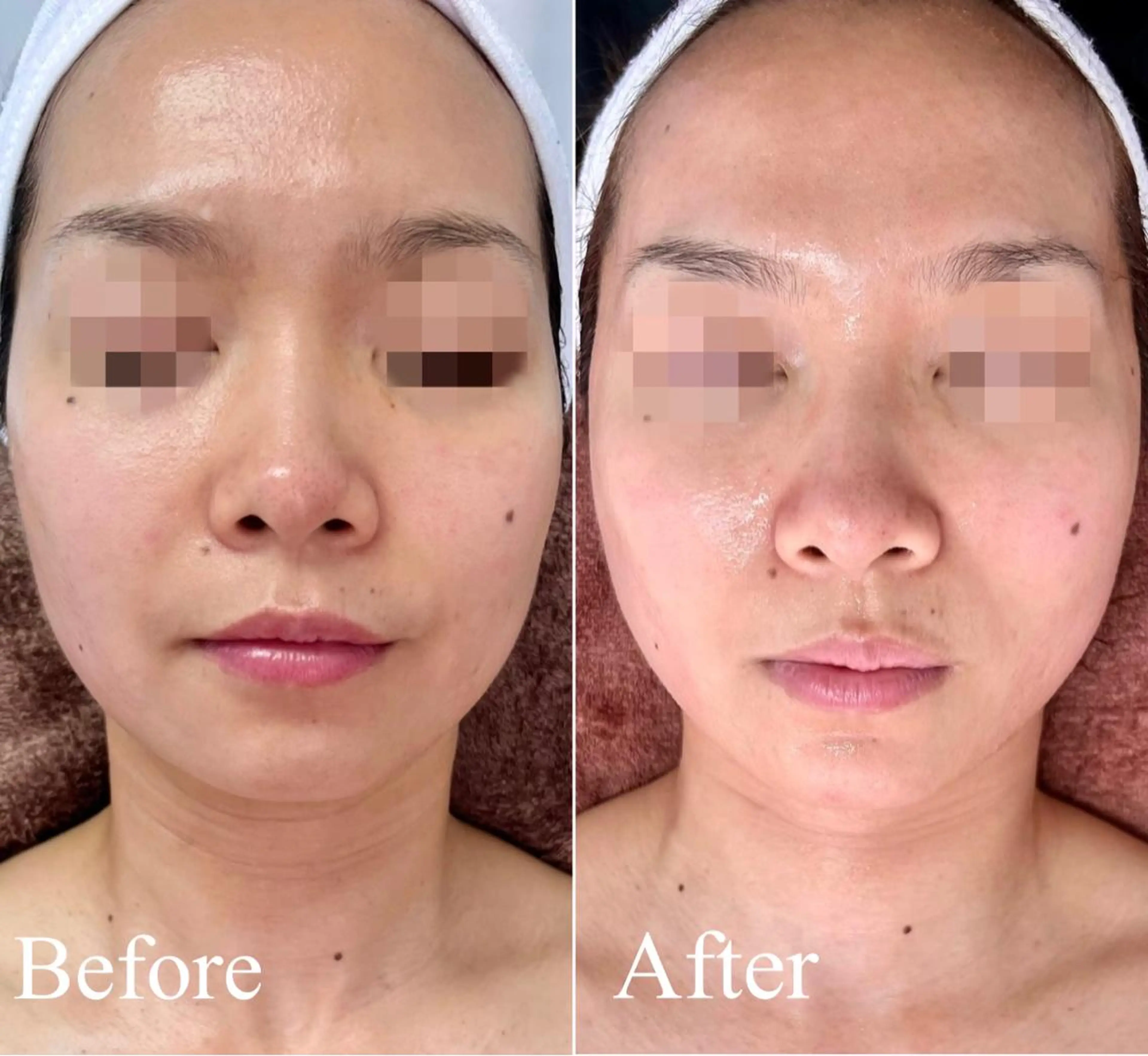 医療提携美容サロン Beatriceのエステ・リラクイメージ