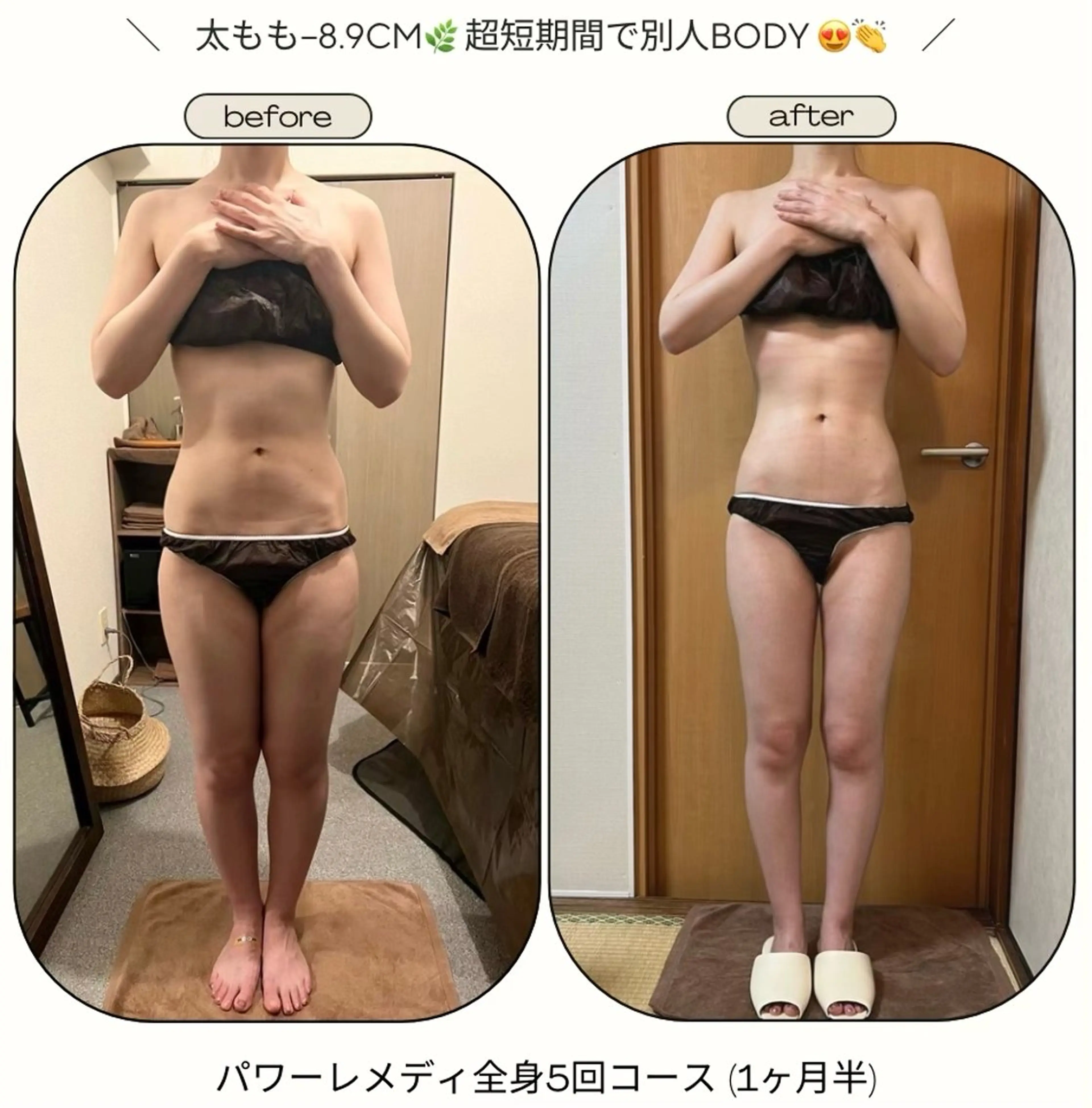 biloop所属・《本気痩せ×疲労改善 》  BILOOPのエステ・リラクイメージ