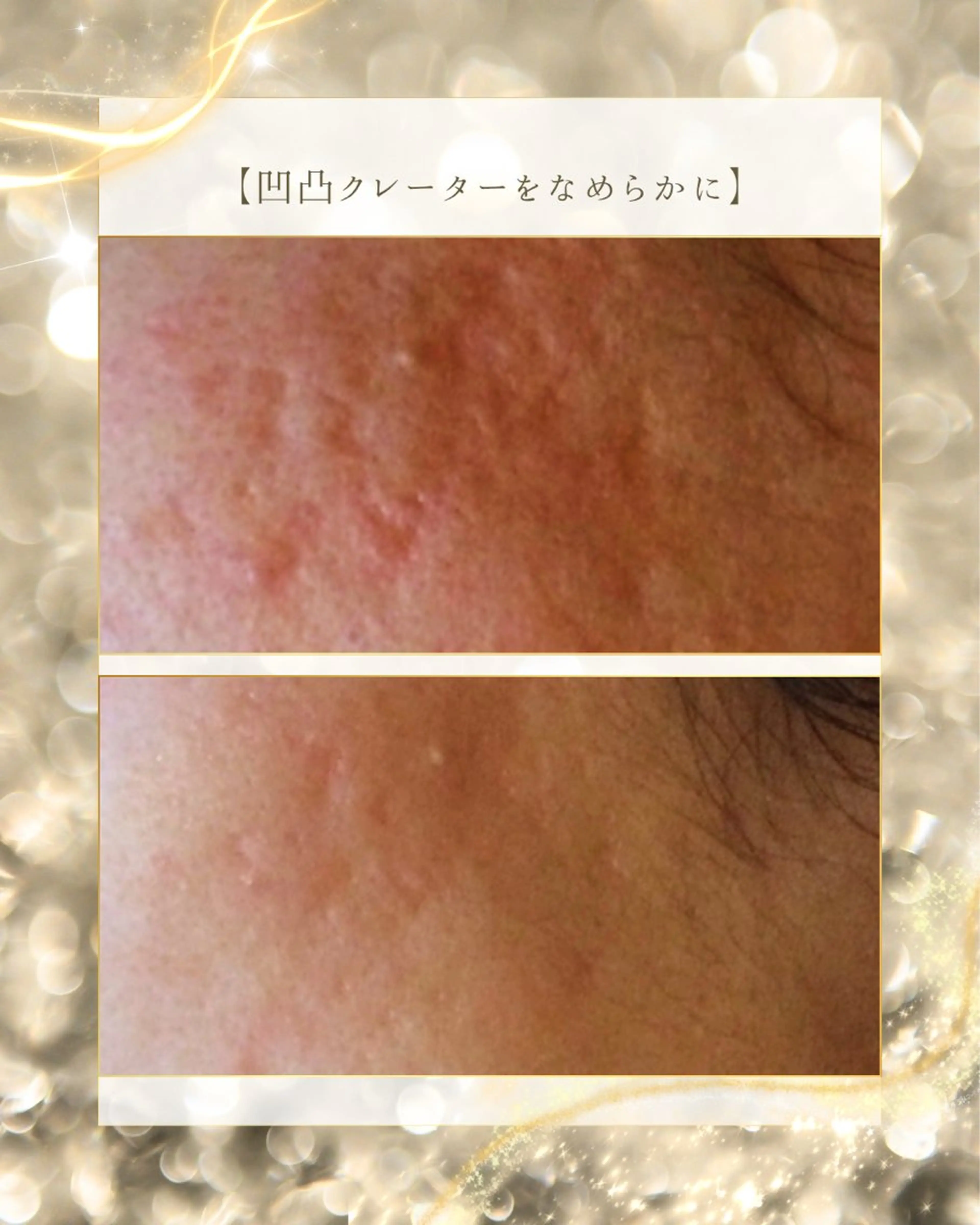 ニキビ/肌質改善専門 Snow skinのエステ・リラクイメージ