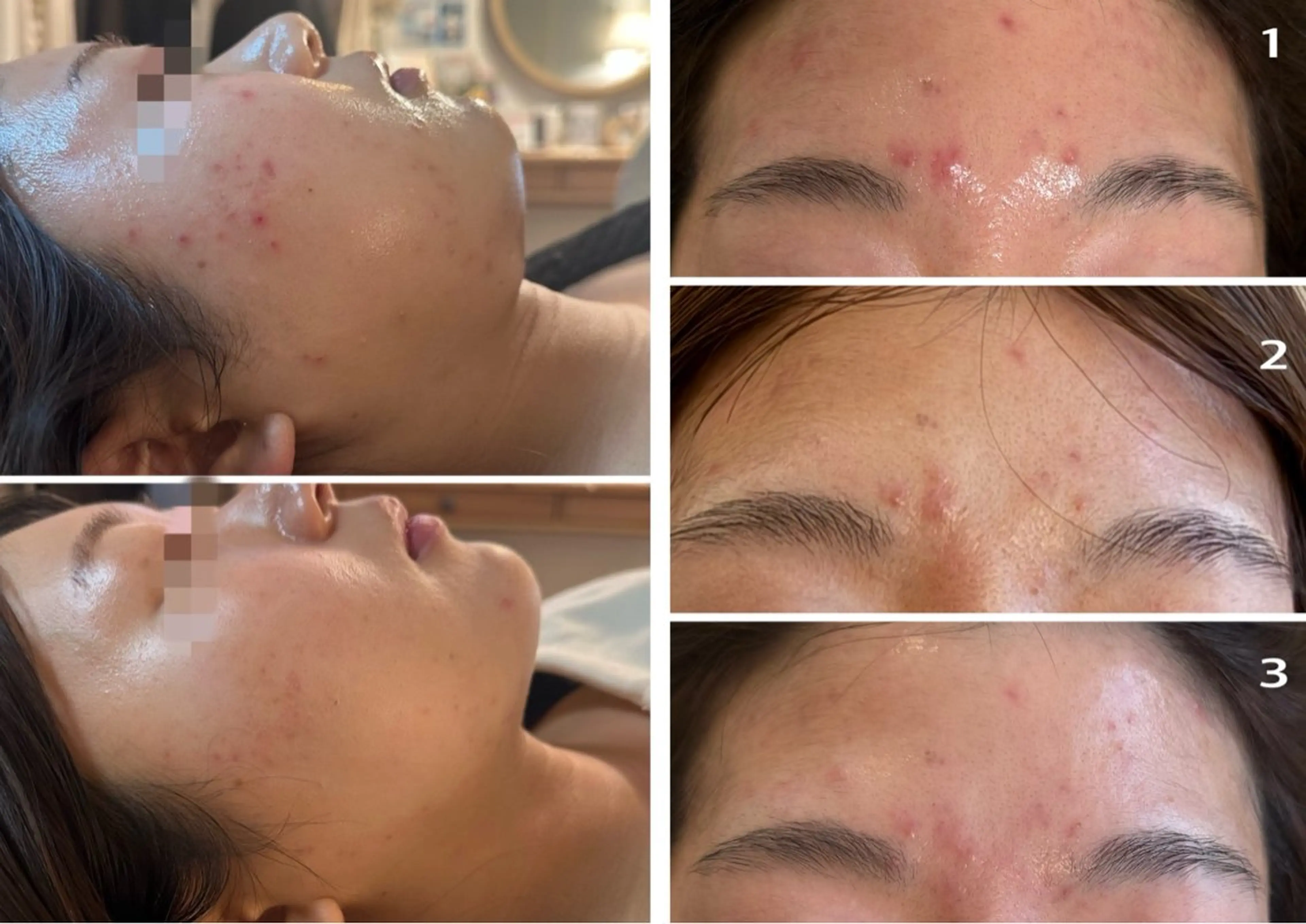 エステ 小顔＆肌質改善 NICORIのエステ・リラクイメージ