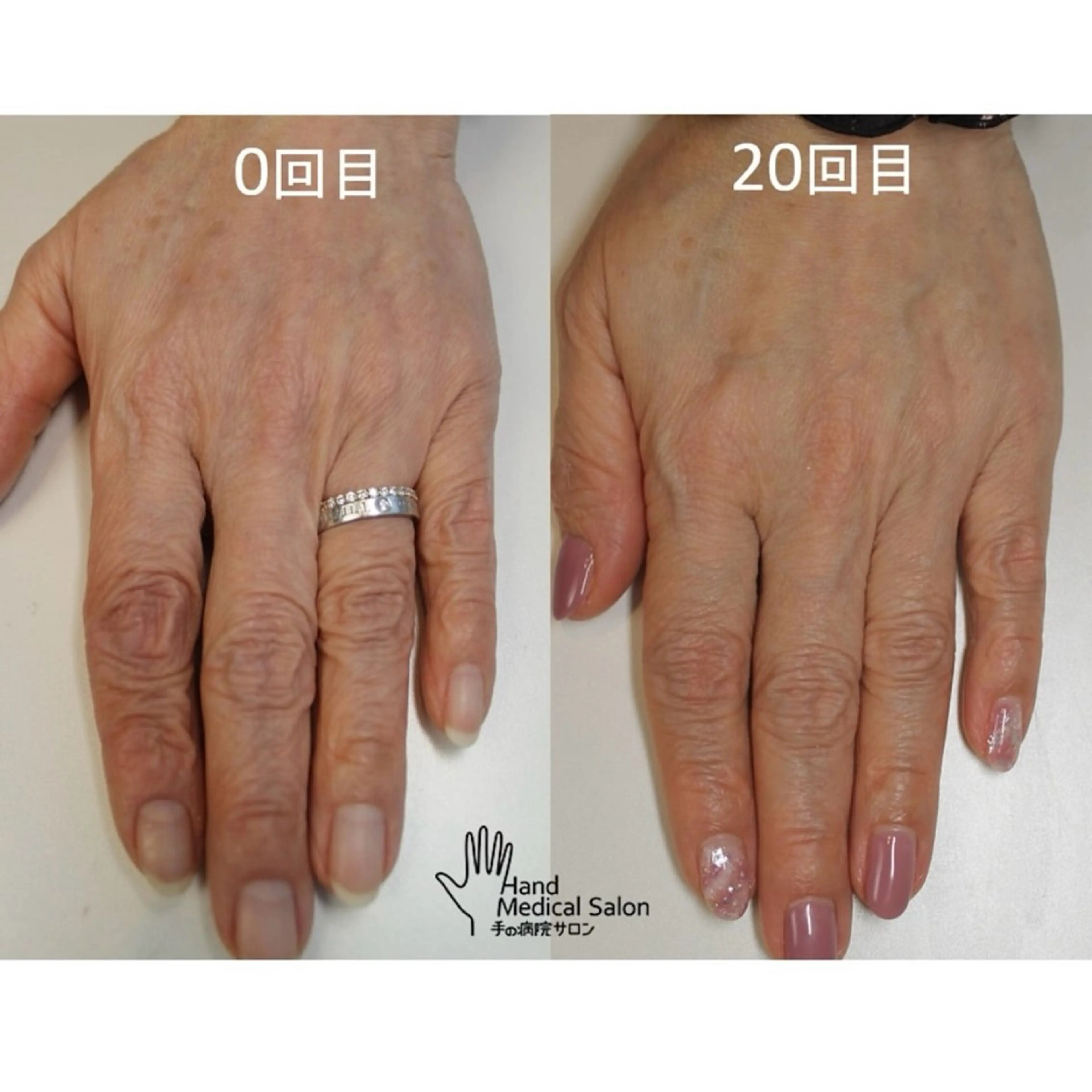 ネイル ジェルネイル オーナーネイリスト 宮添華里のネイルデザイン