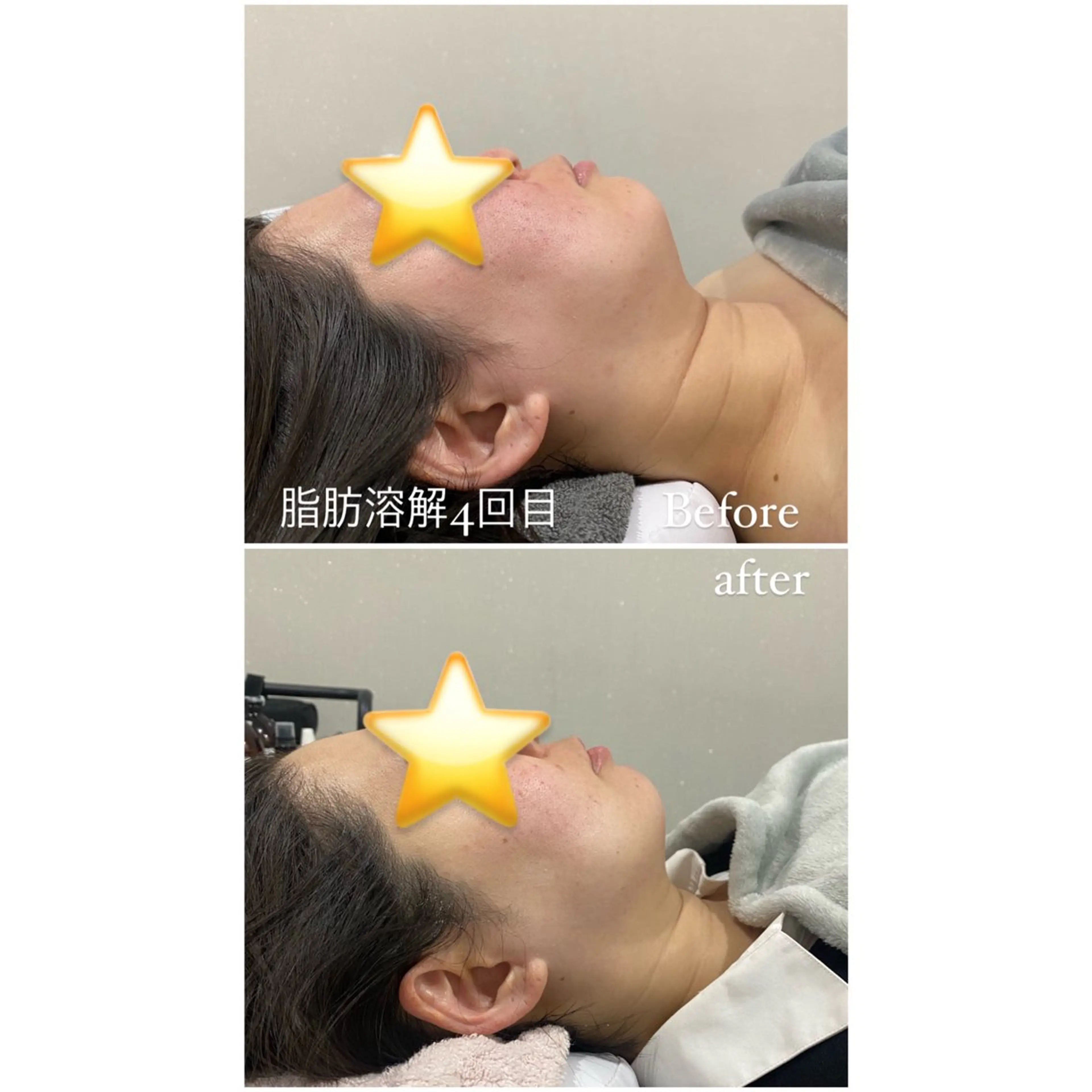 エステ 毛穴洗浄・痩身・脱毛 /アルカンジュのエステ・リラクイメージ