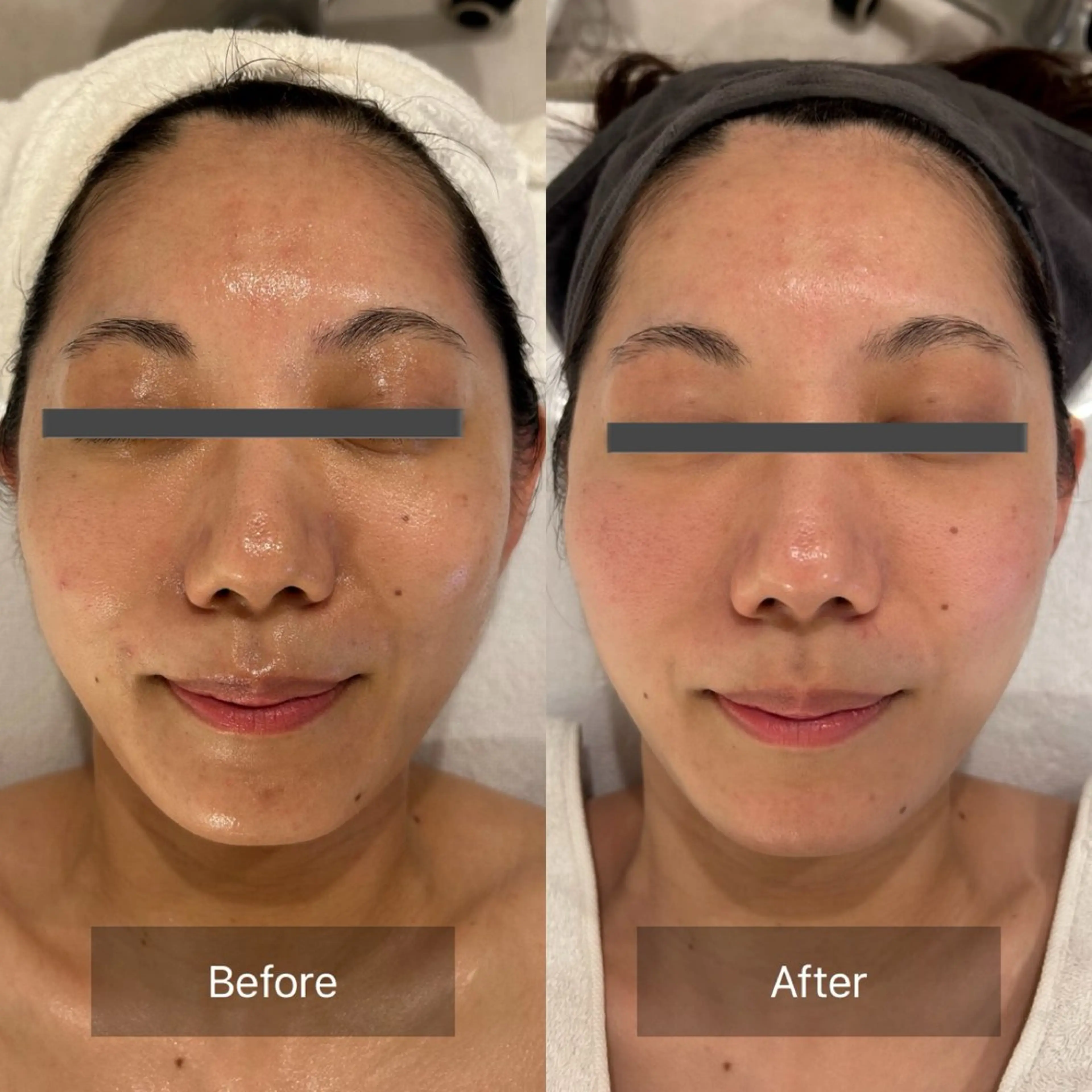 mine.mi マインエムのエステ・リラクイメージ