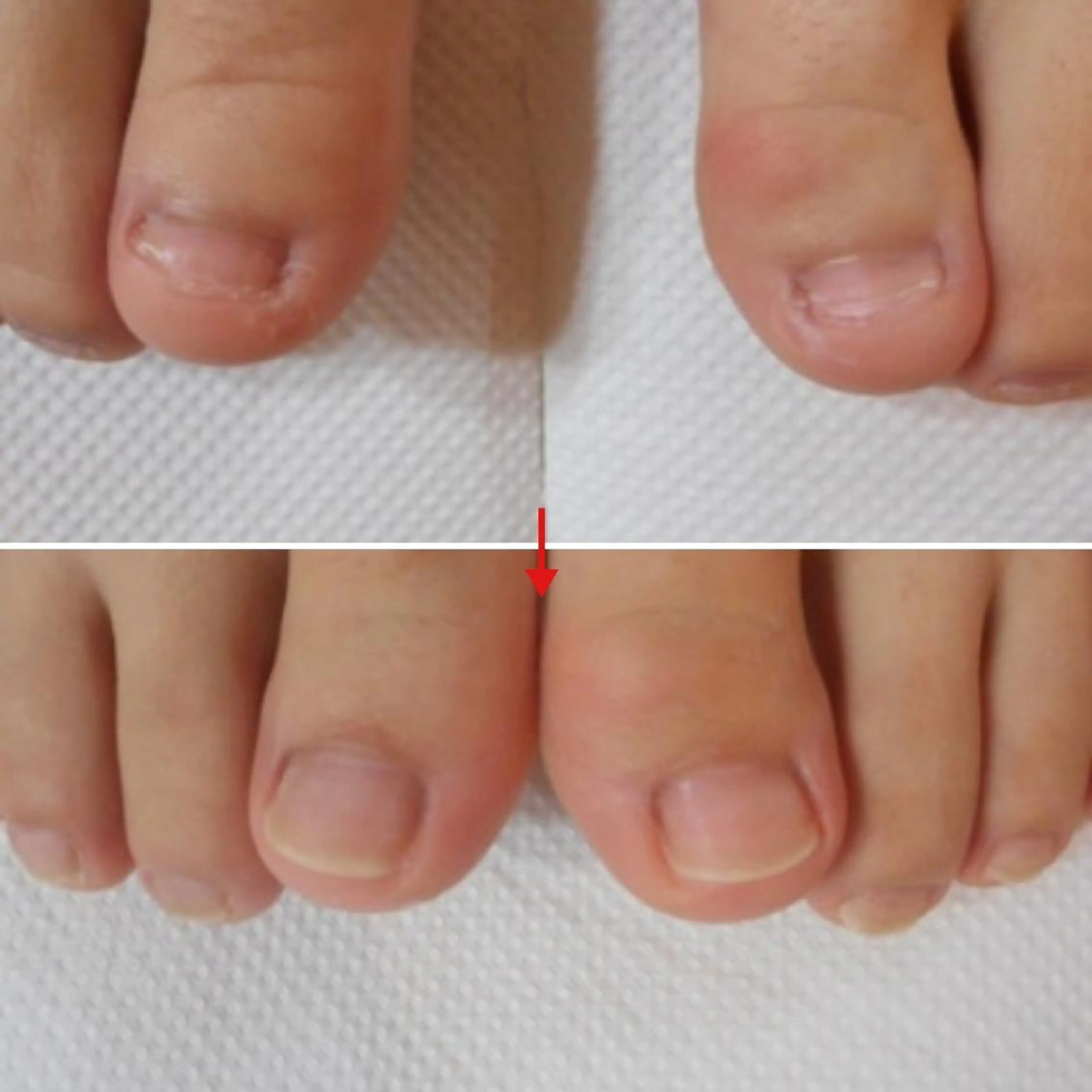 ネイル フットネイル フットネイル ネイルサロンアリューム所属・ネイルサロン アリュームのネイルデザイン