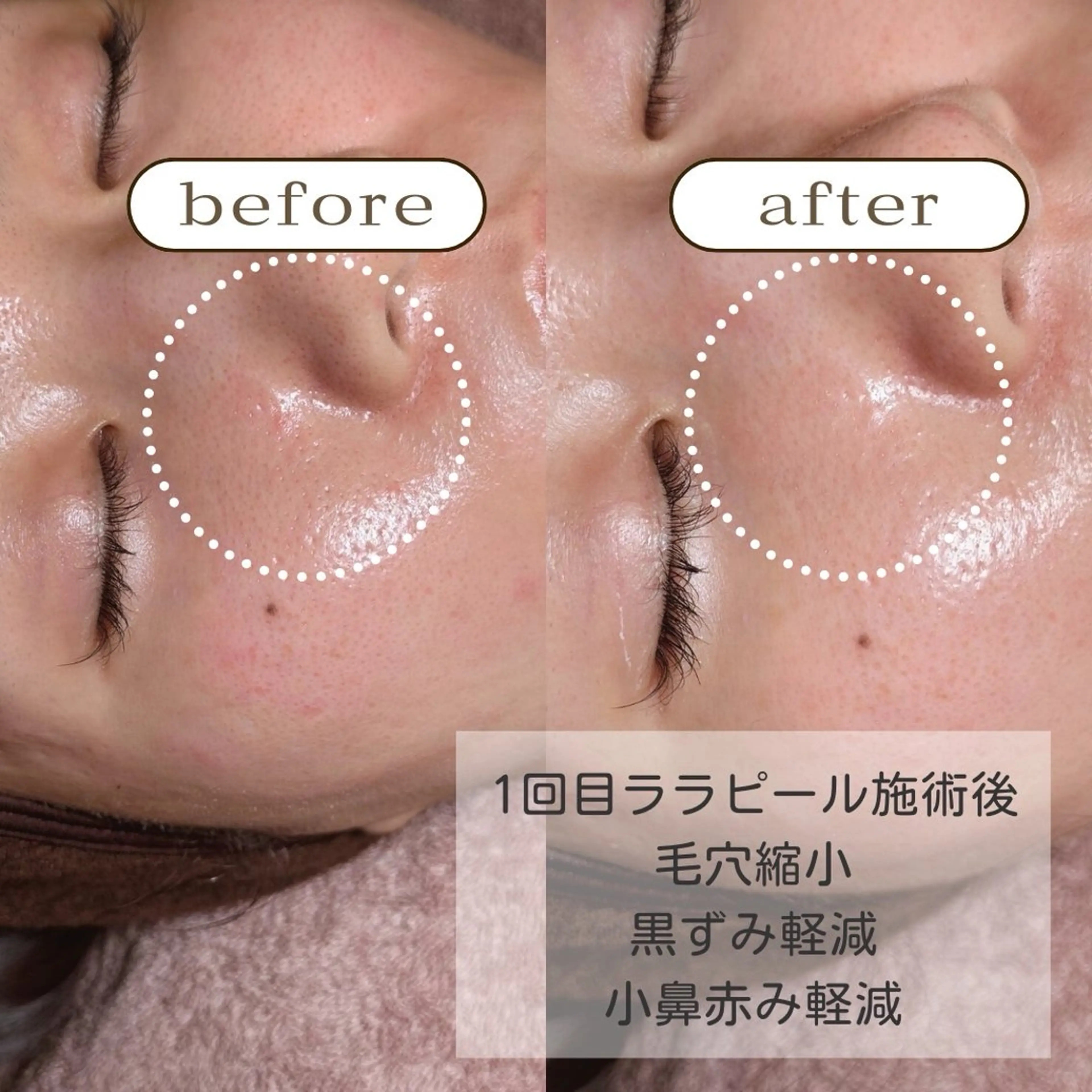 エステ 美肌・痩身・脱毛当日 予約◎ZENITHのエステ・リラクイメージ