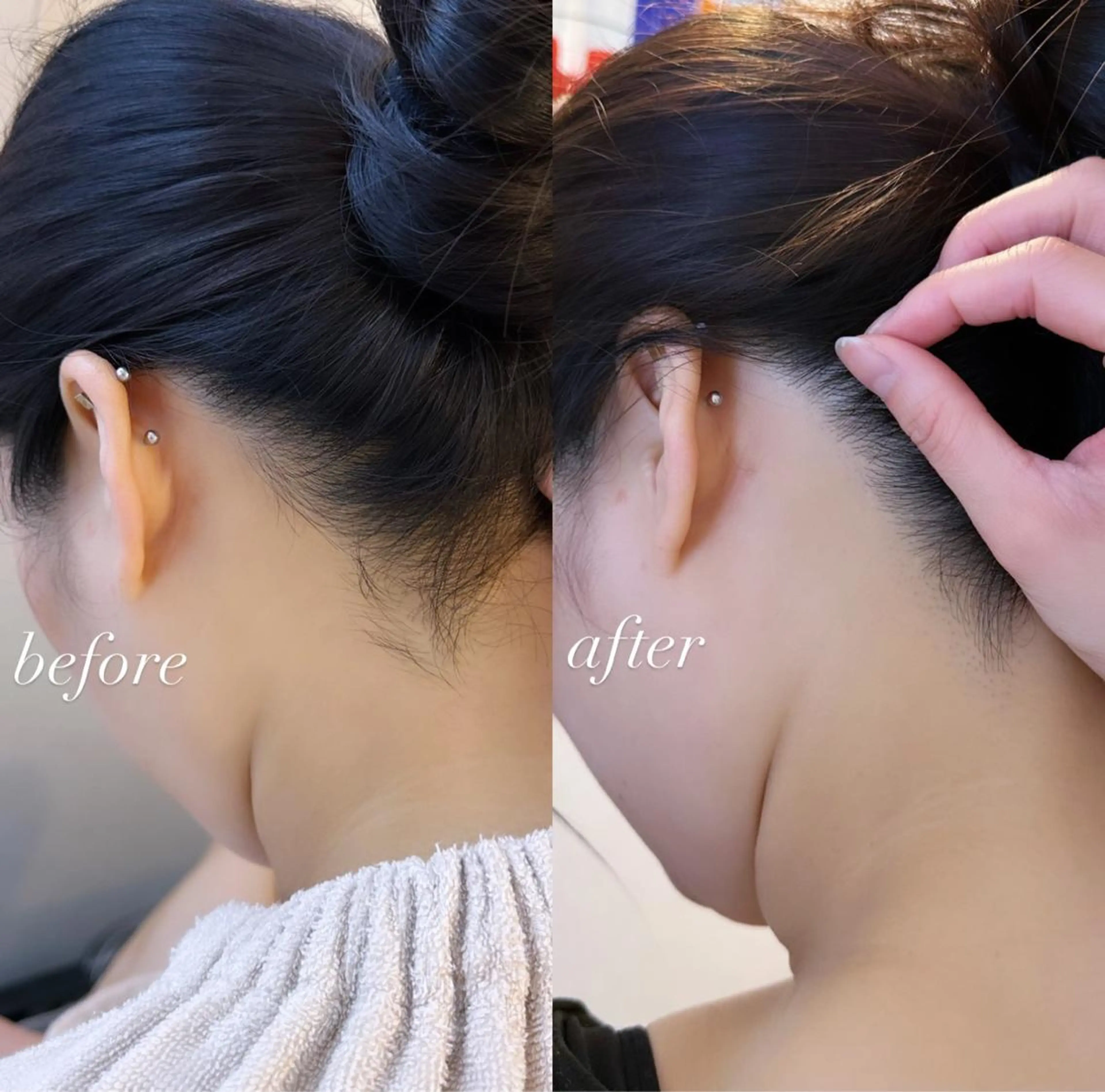 うなじ脱毛/美肌脱毛 LABELのエステ・リラクイメージ