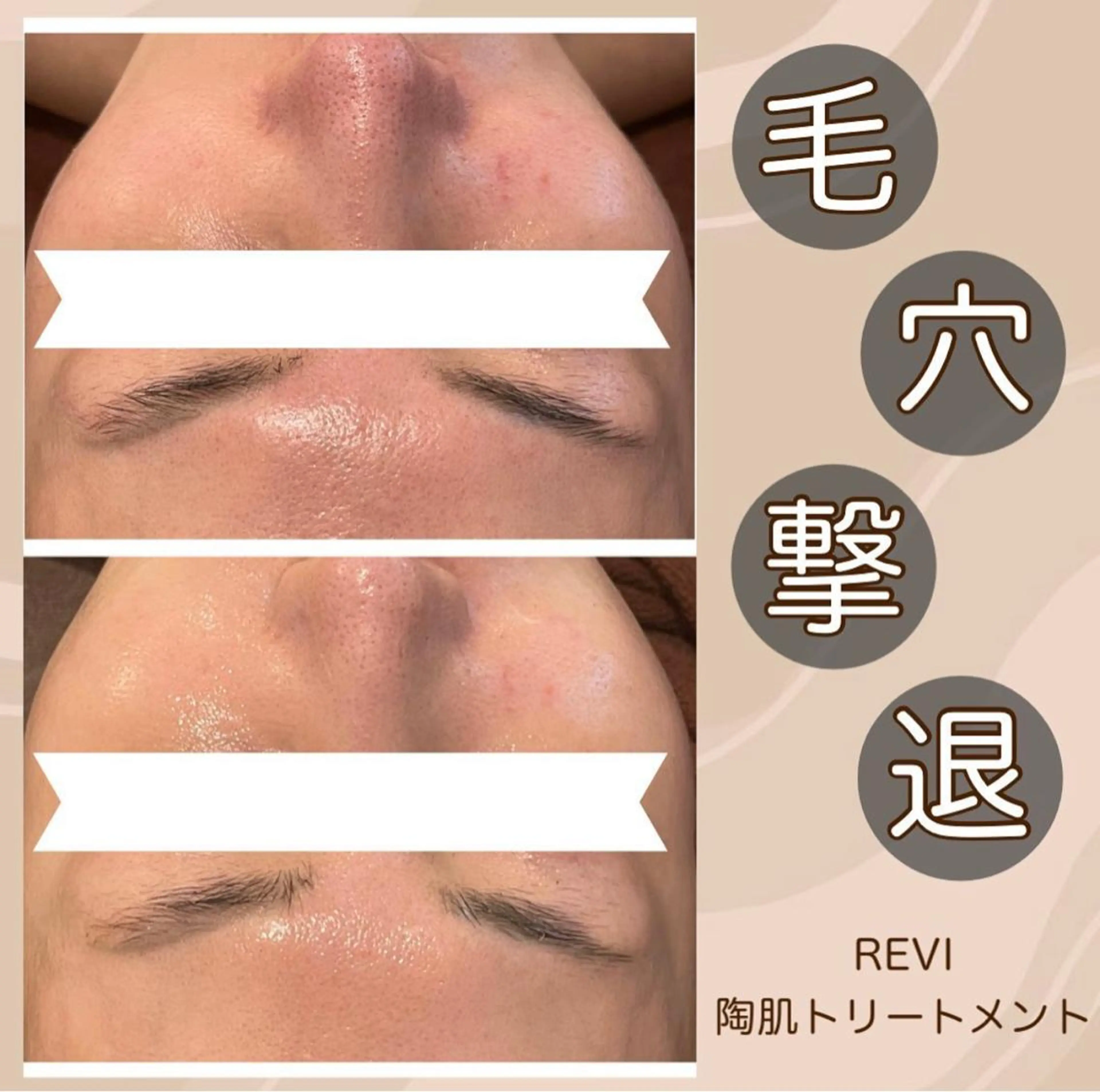 トラブル肌改善🏥 Meow！🫧🫧のエステ・リラクイメージ