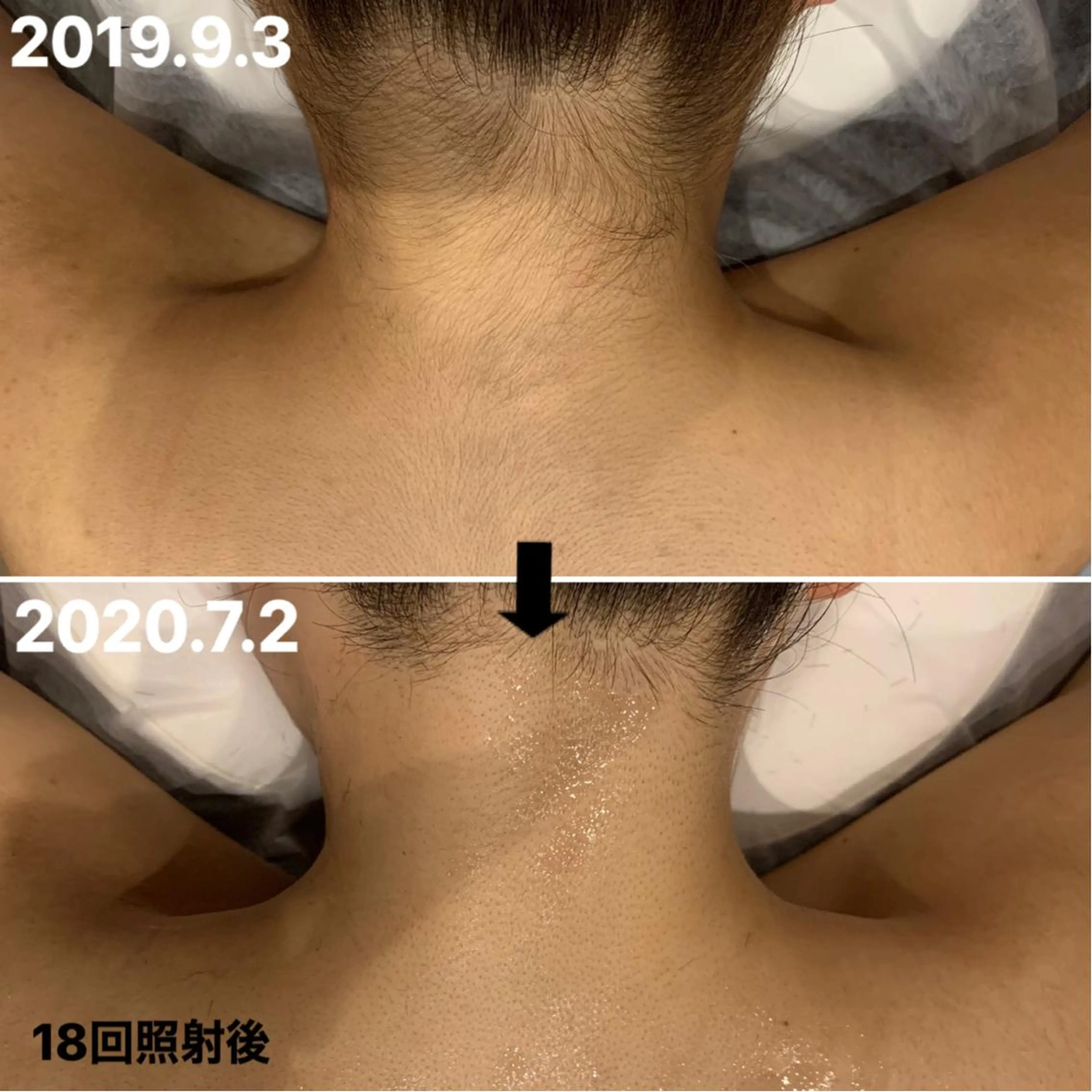 脱毛＆エステサロン【アンリミット】所属・森谷 莉美のエステ・リラクイメージ