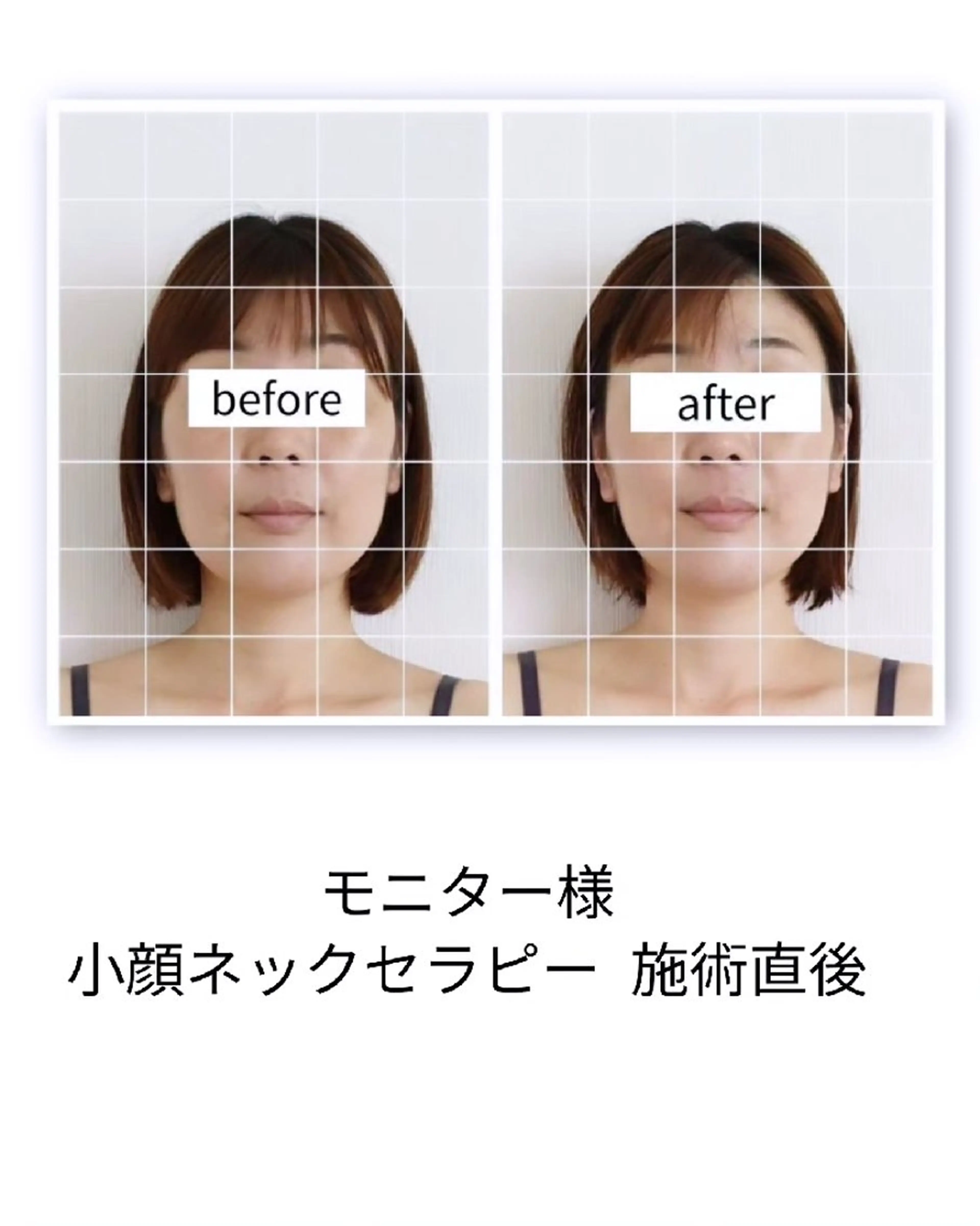 桜井市｜小顔・ 美容矯正 madoiのエステ・リラクイメージ