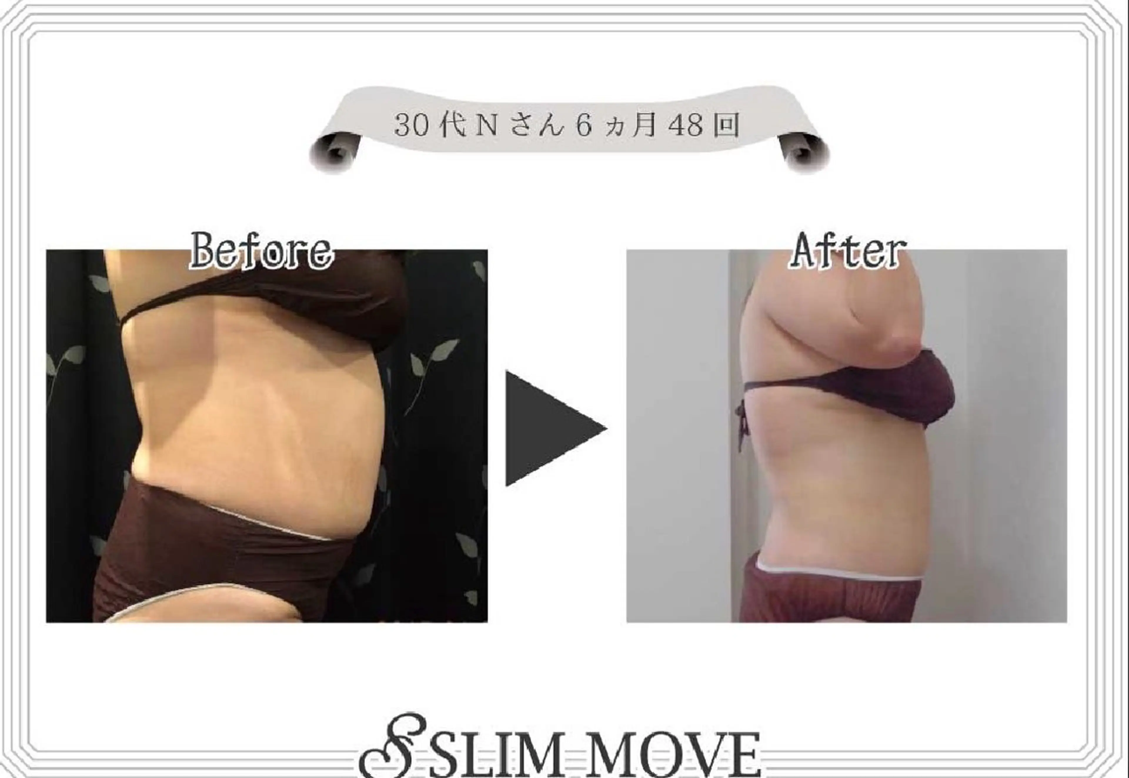 スリムムーブ上半身60分コース15000円→6990円デコルテマッサージ付きの写真