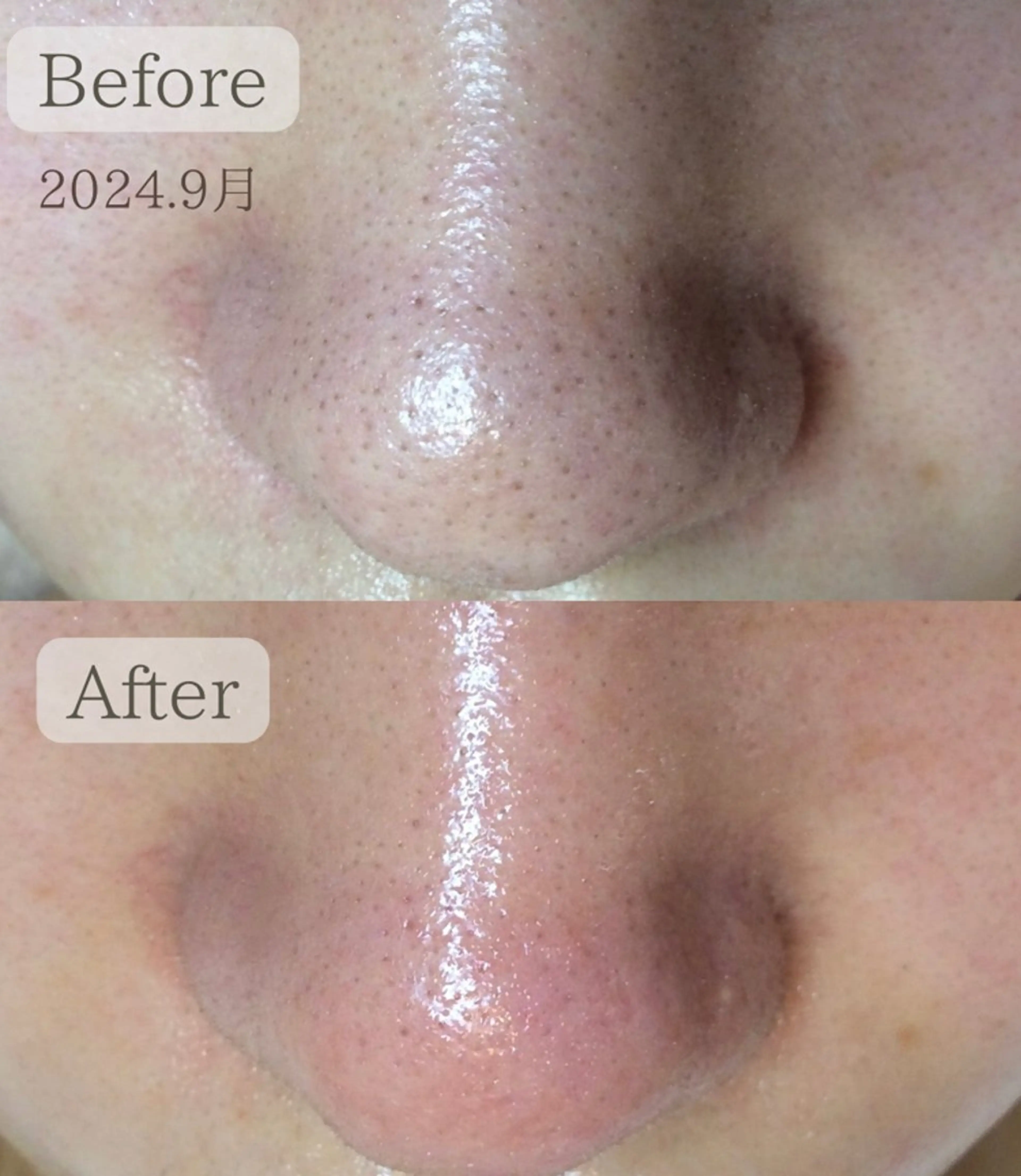 エステ エステサロン　Lazulisea所属・川口 春奈のエステ・リラクイメージ