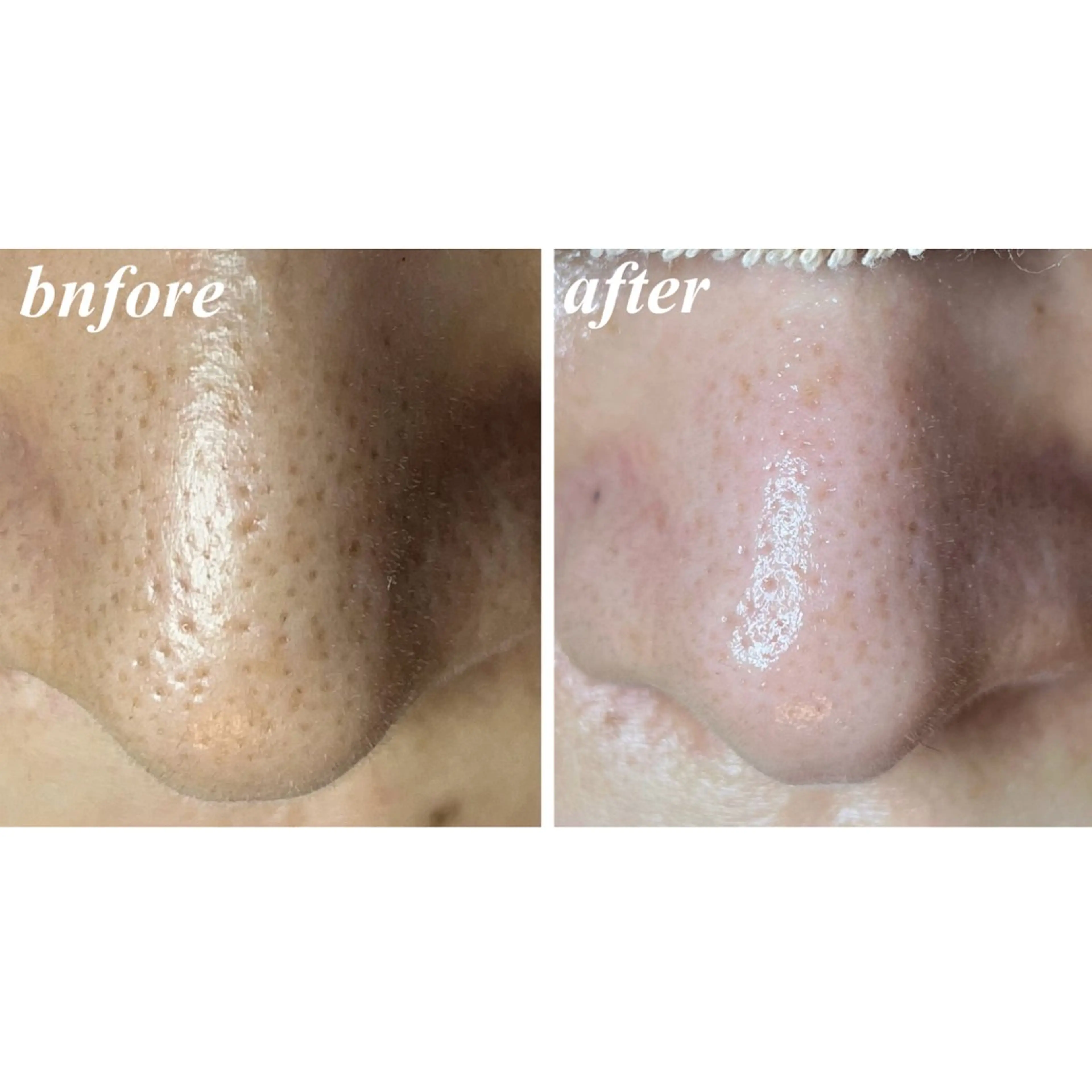 結果重視｜毛穴エステ ｜友綱理恵のエステ・リラクイメージ