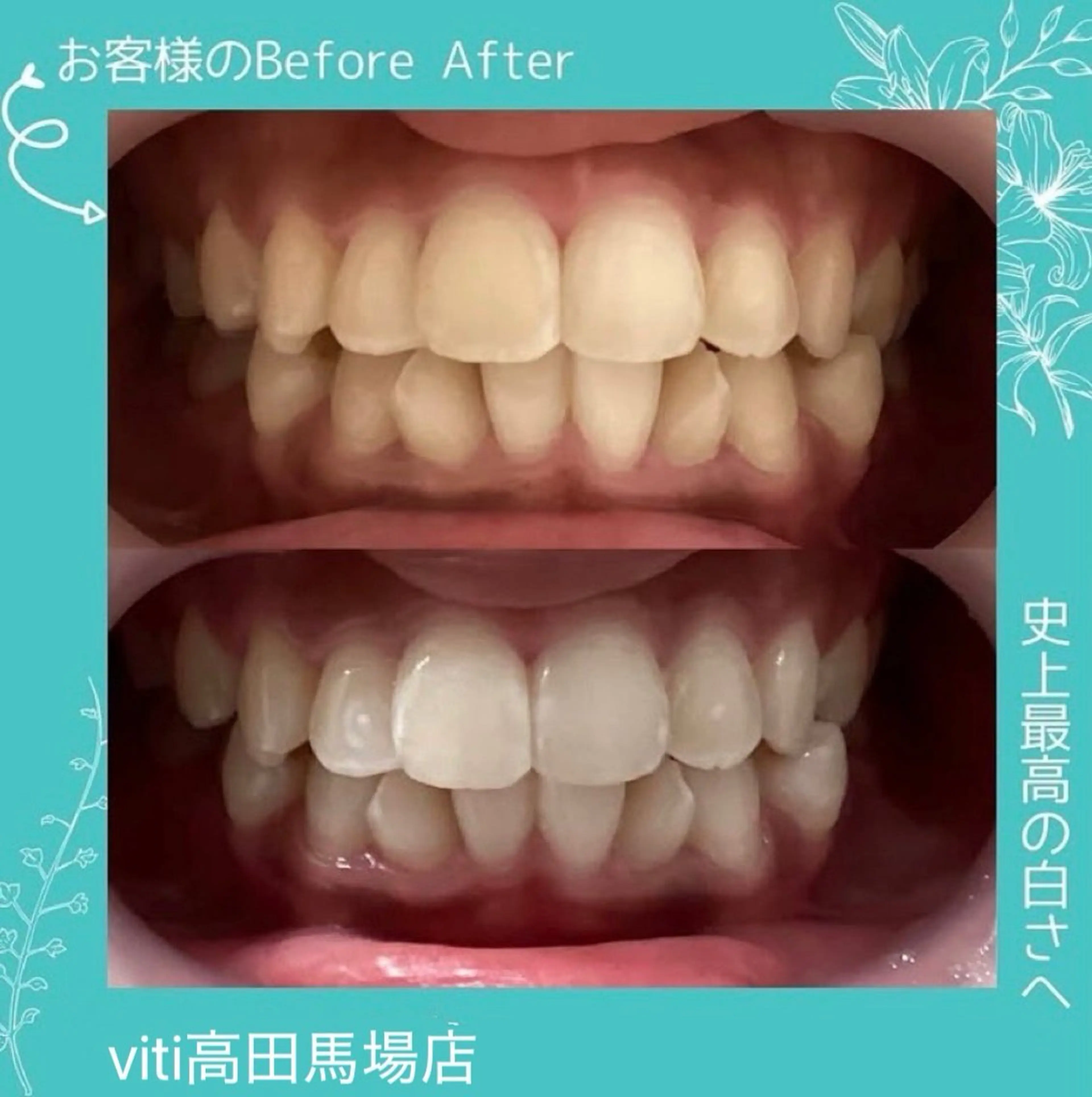 その他 viti 高田馬場店のその他イメージ