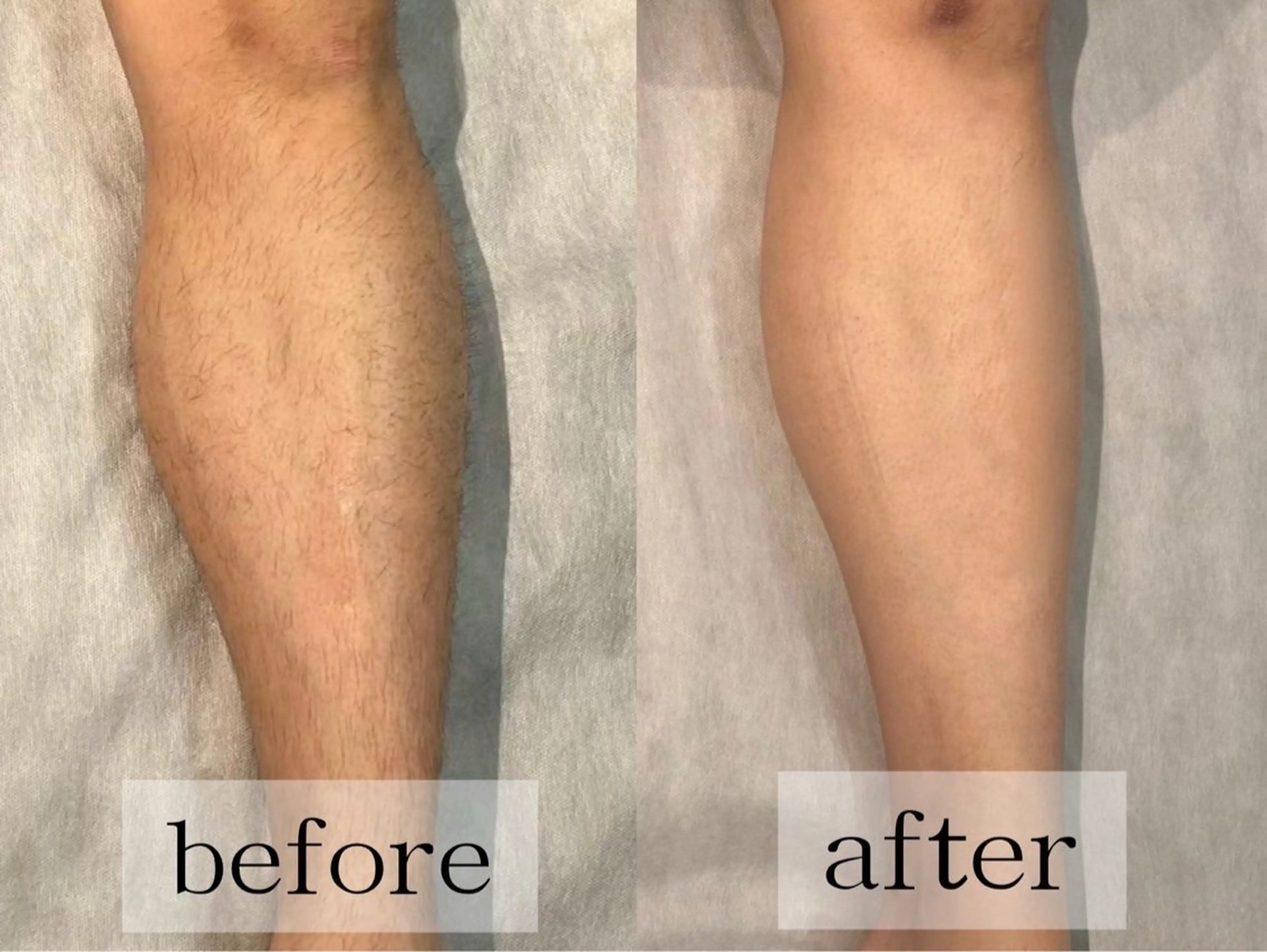 毛穴・肌質ケア専門 グランビューティーのエステ・リラクイメージ