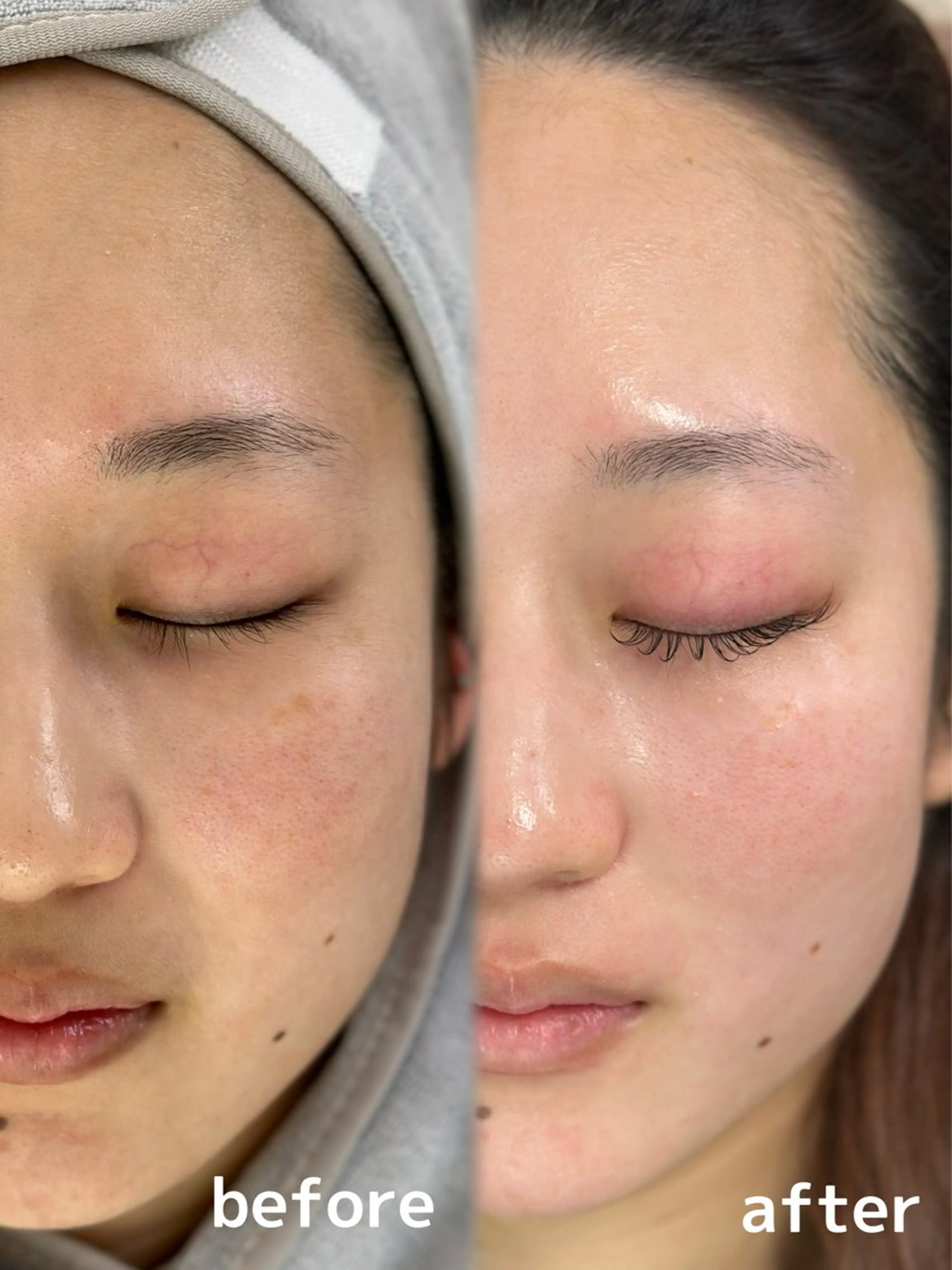 脱毛 Suzu .muse 【葛城店】のマツエク・マツパデザイン