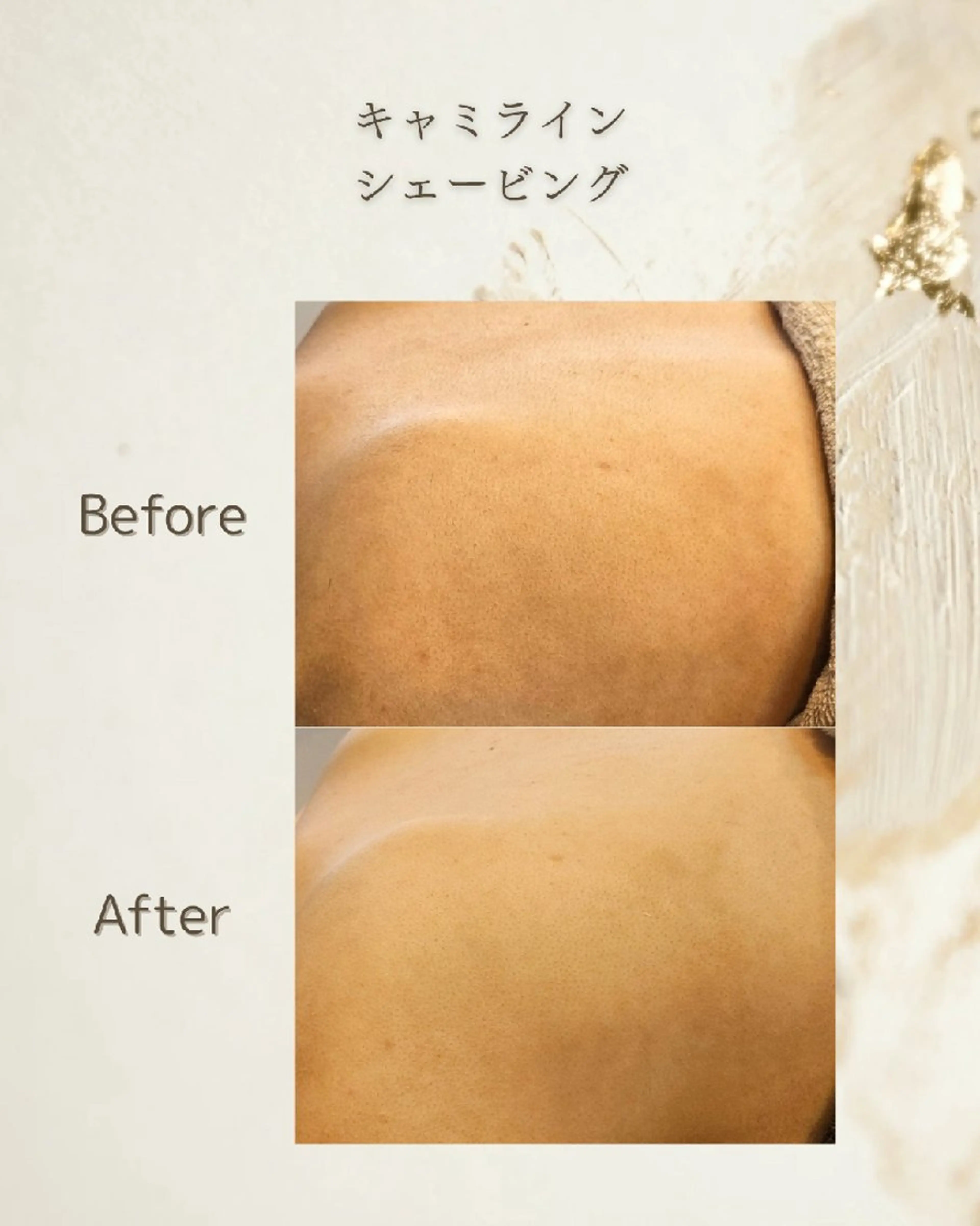 エステ シェービングサロン アンダブル/鴨井のその他イメージ