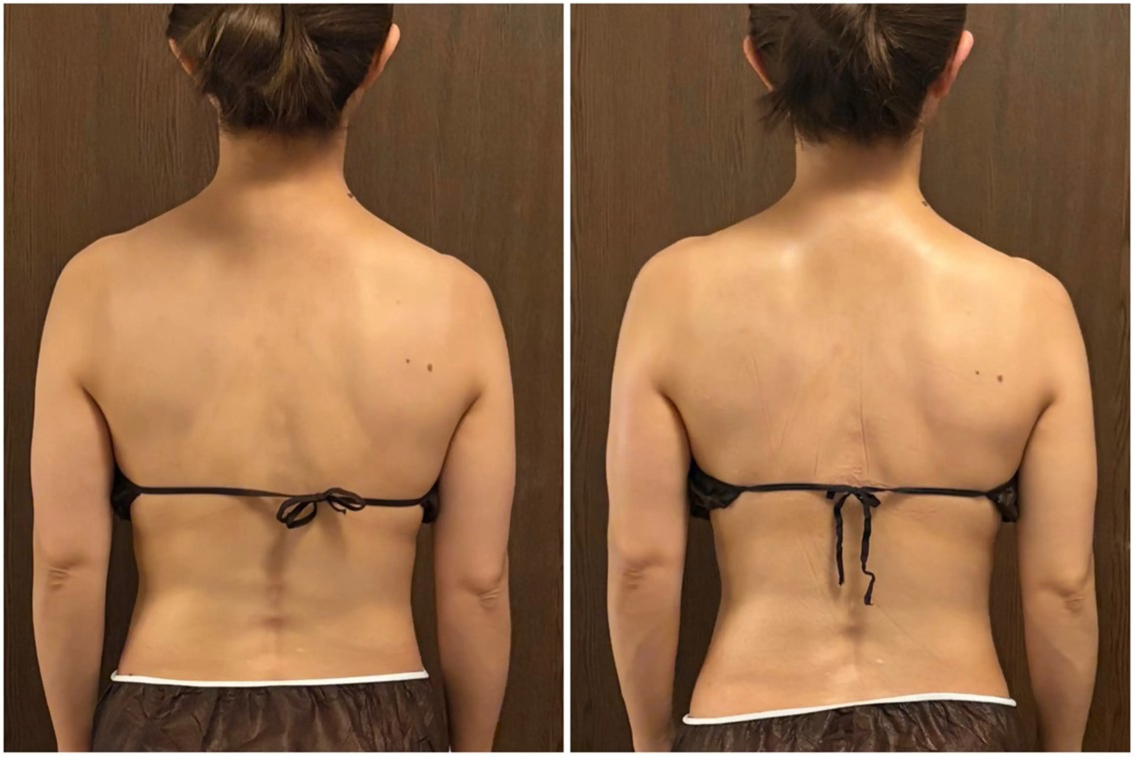 腸もみ×全身リンパで内側から整え、むくみ・便秘・肩こりスッキリ✨1回でも変化を実感しやすく、ウエストや姿勢も整います🌿の写真