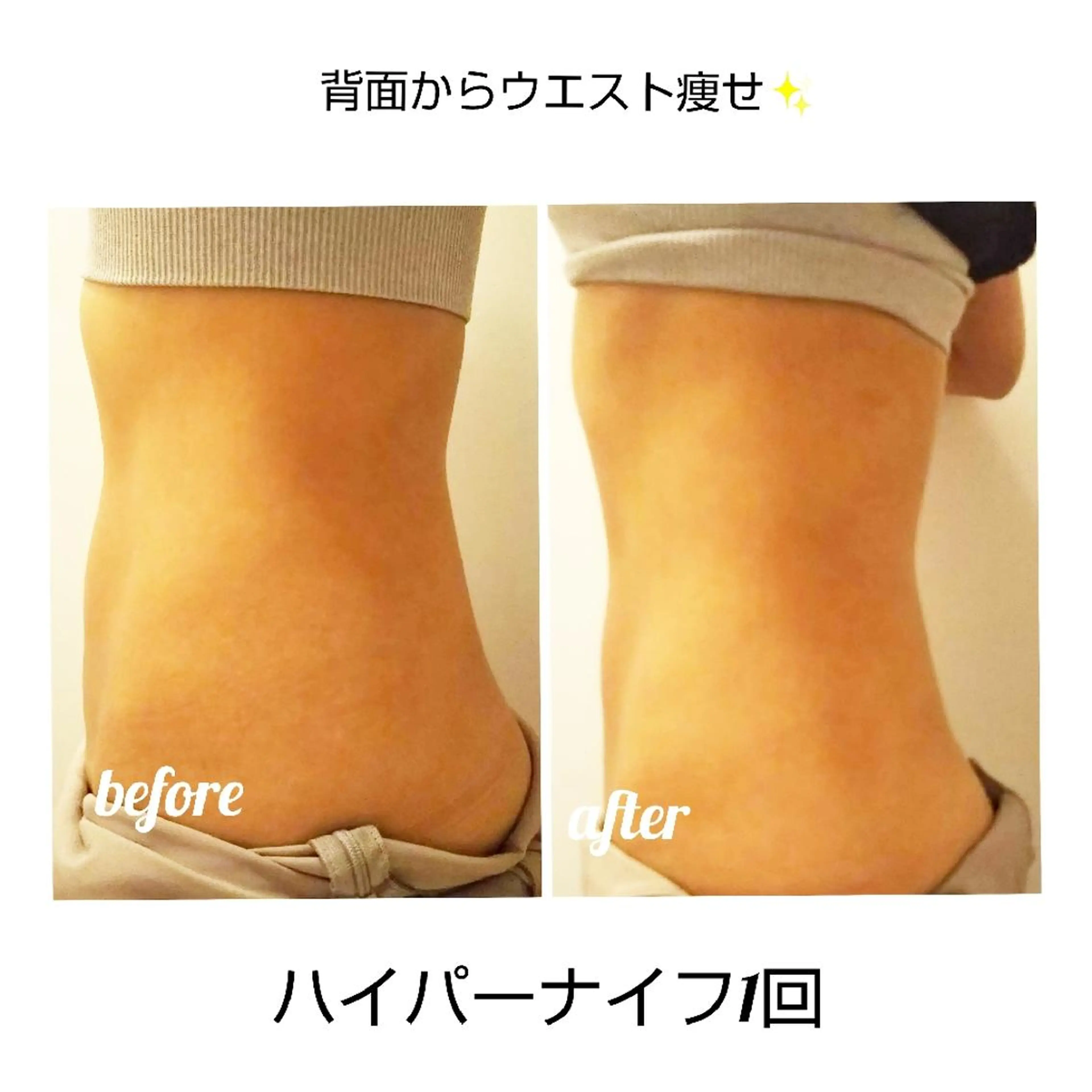 【ニキビ/肌管理】 salon varyのエステ・リラクイメージ