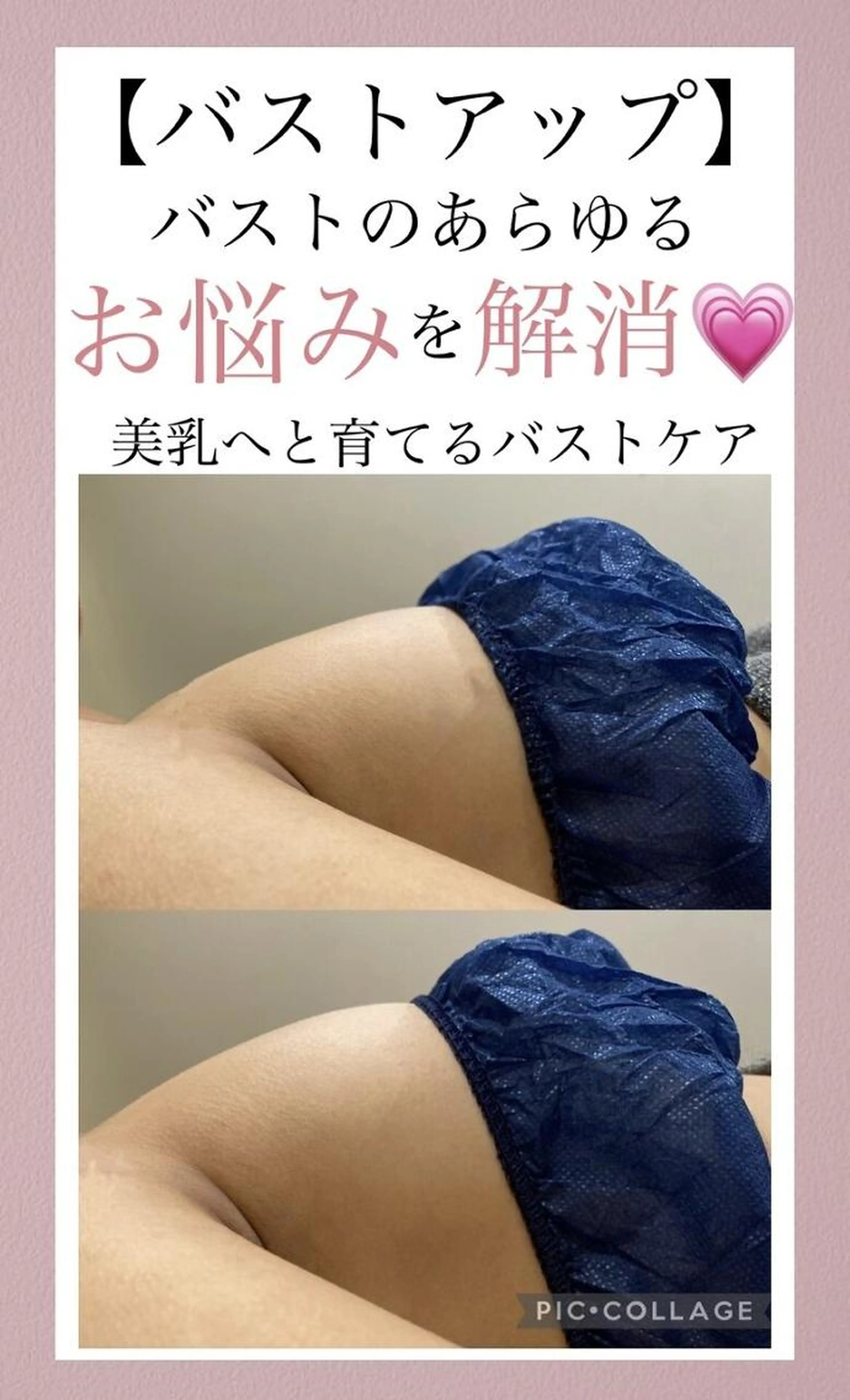 【バストアップのお悩み解決】高技術×知識量◎ボリューム/形崩れ/垂れ/萎みの写真