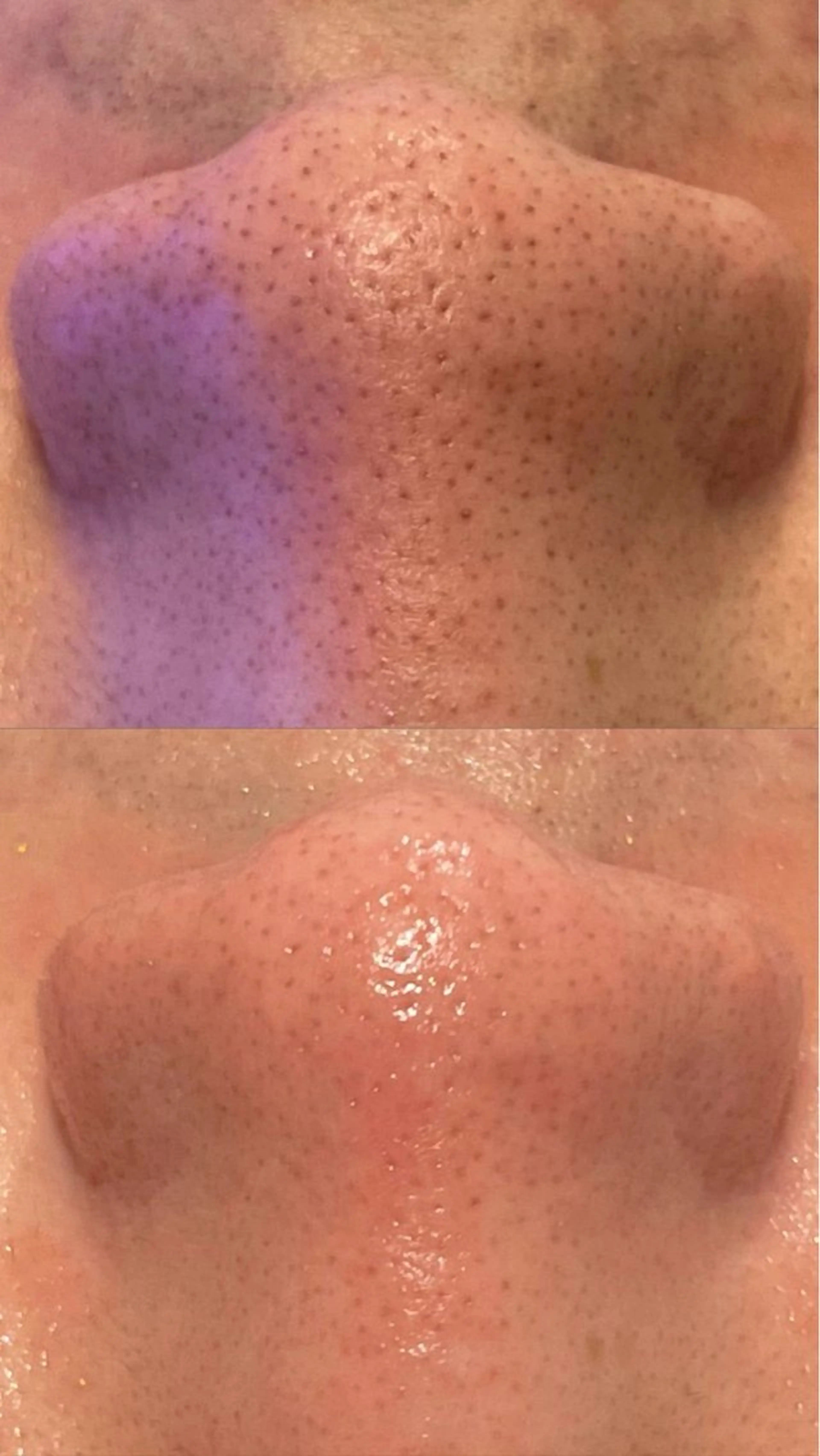 毛穴洗浄専門サロン/CareNa梅田【毛穴/ケアナ】所属・CareNa梅田店 🌿Mihoのエステ・リラクイメージ