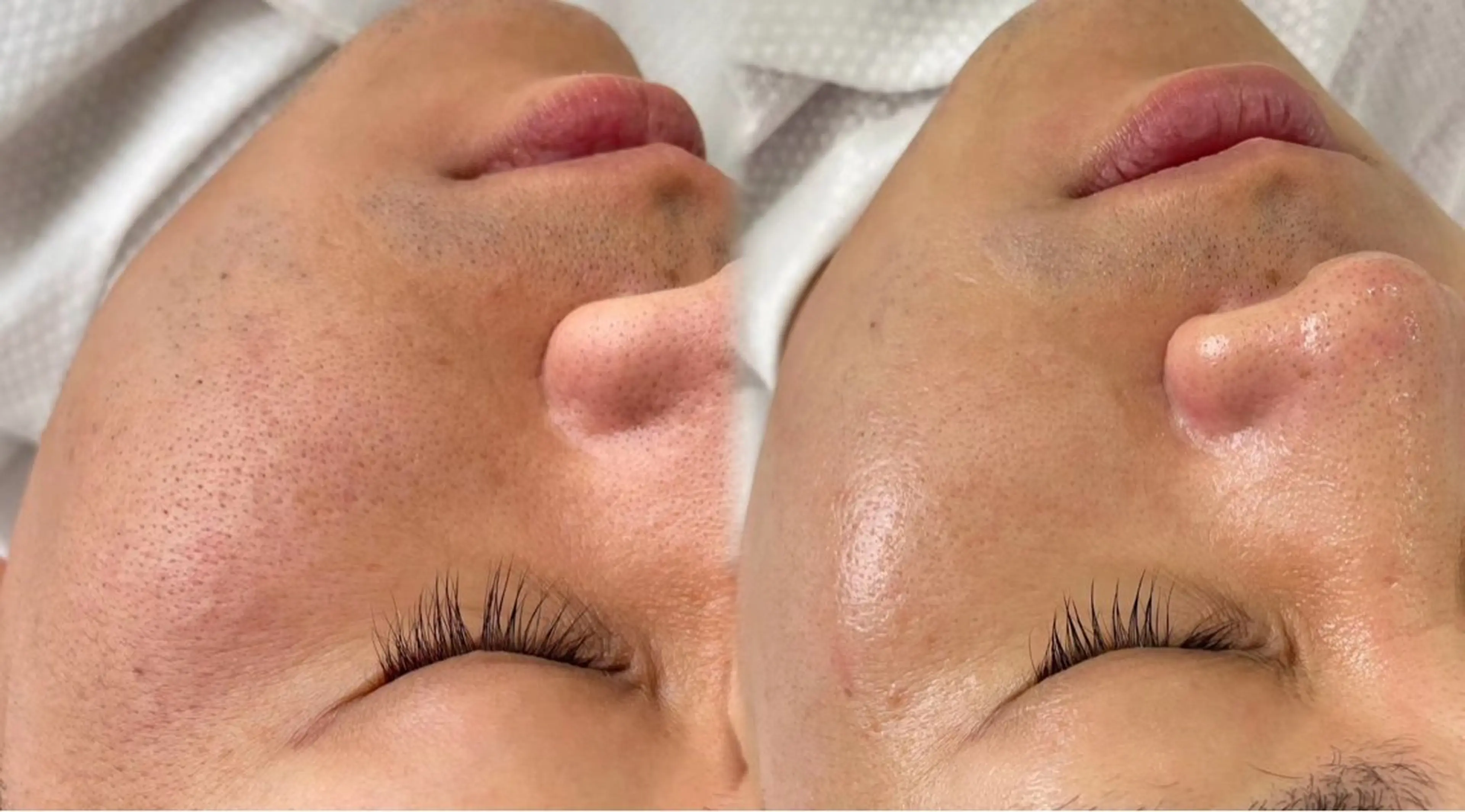 エステ リラク 愛維美水光美肌専門店所属・愛維美水光美肌専門店 メンズレディースokのエステ・リラクイメージ