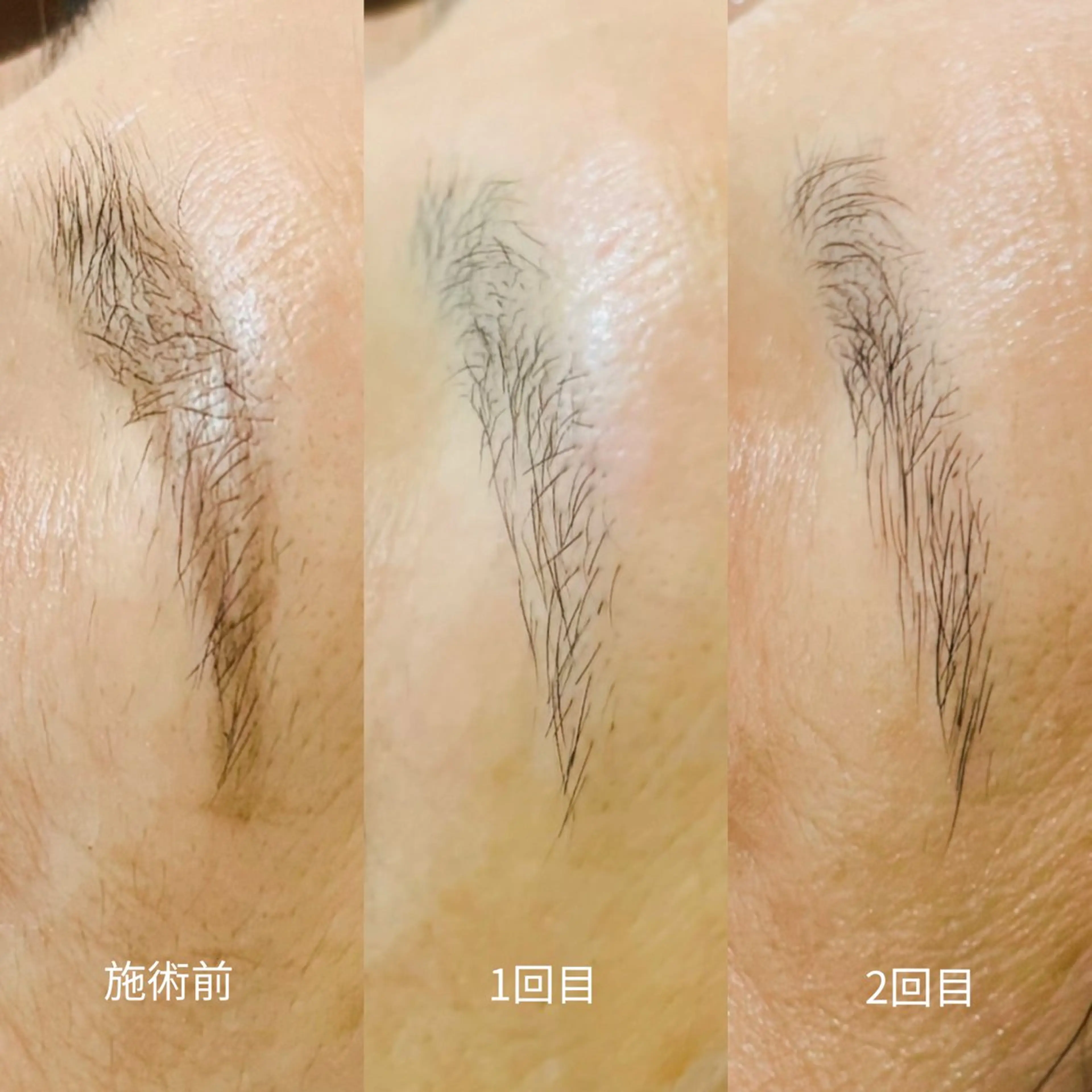 アイブロウ ワックス脱毛 眉カット その他(アイブロウ) 小顔美肌&ヘアメイク 丸山紗來のその他イメージ