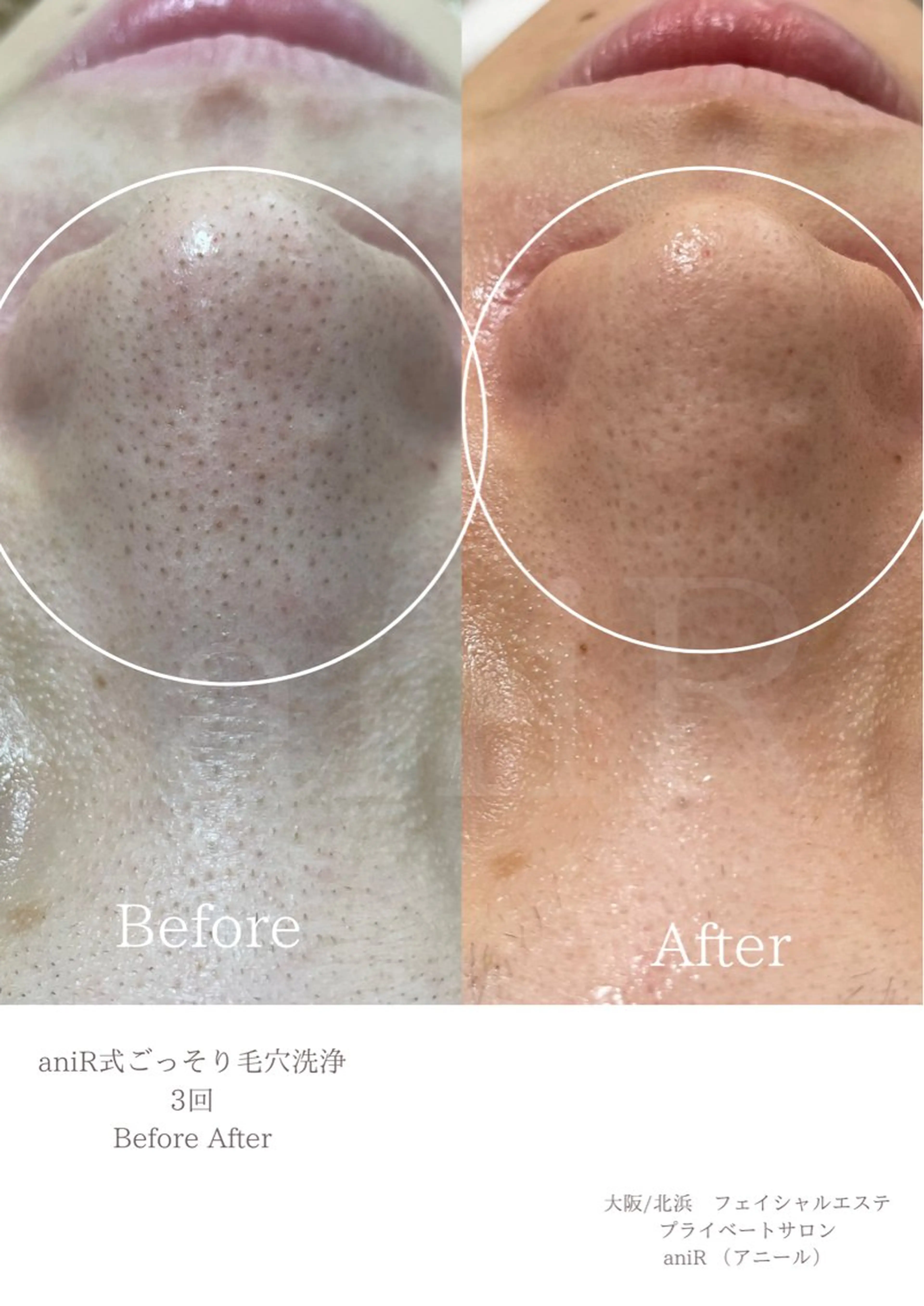 北浜/毛穴洗浄ツヤ肌 サロンaniRのエステ・リラクイメージ