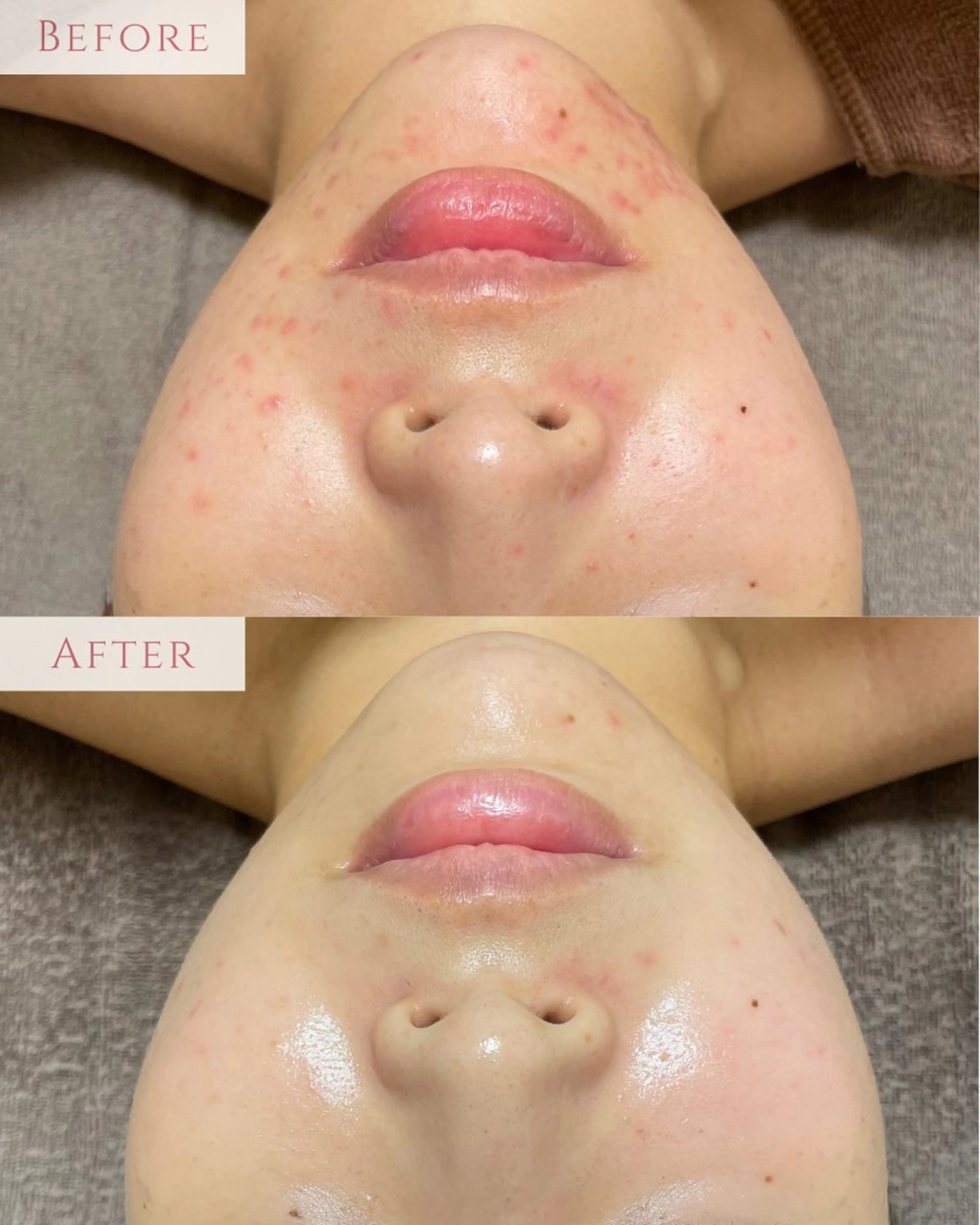 エステ 肌質改善サロン LesFleursのエステ・リラクイメージ