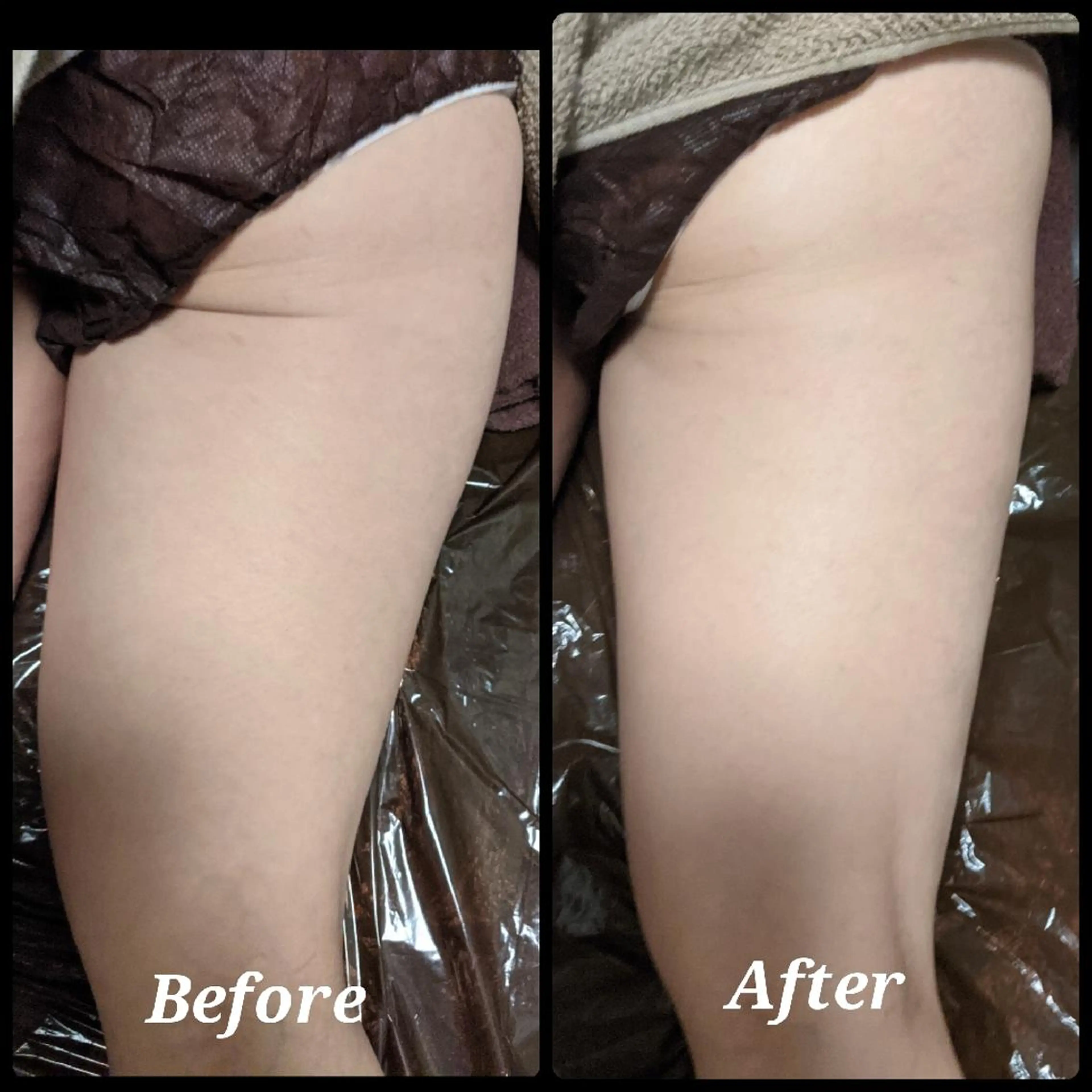 深層リンパオイル/小 顔とドライヘッドスパのエステ・リラクイメージ