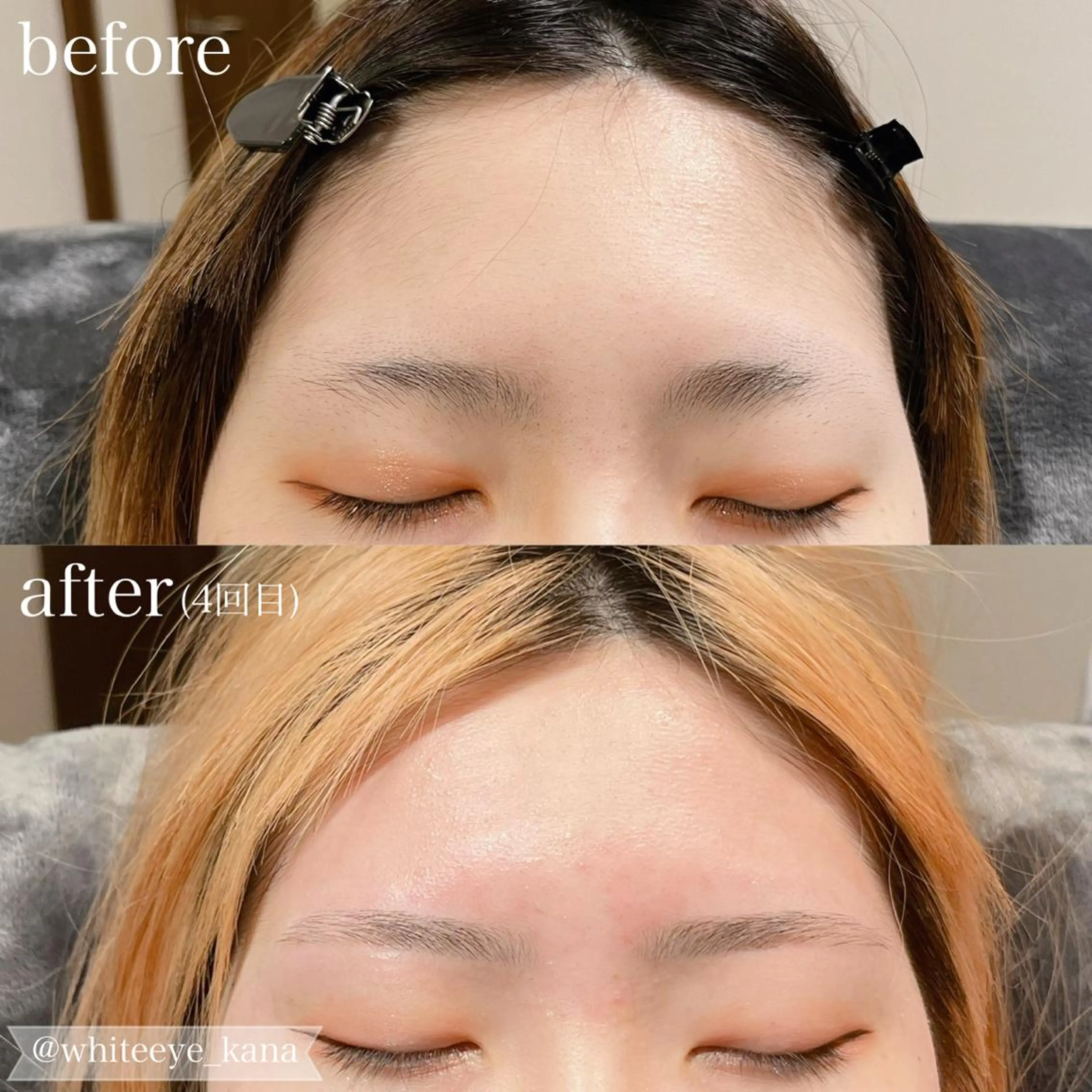 【2回目以降】ツルツルたまご👶🏻🥚✨《SET💖》美眉スタイリング+おでこWAXの写真