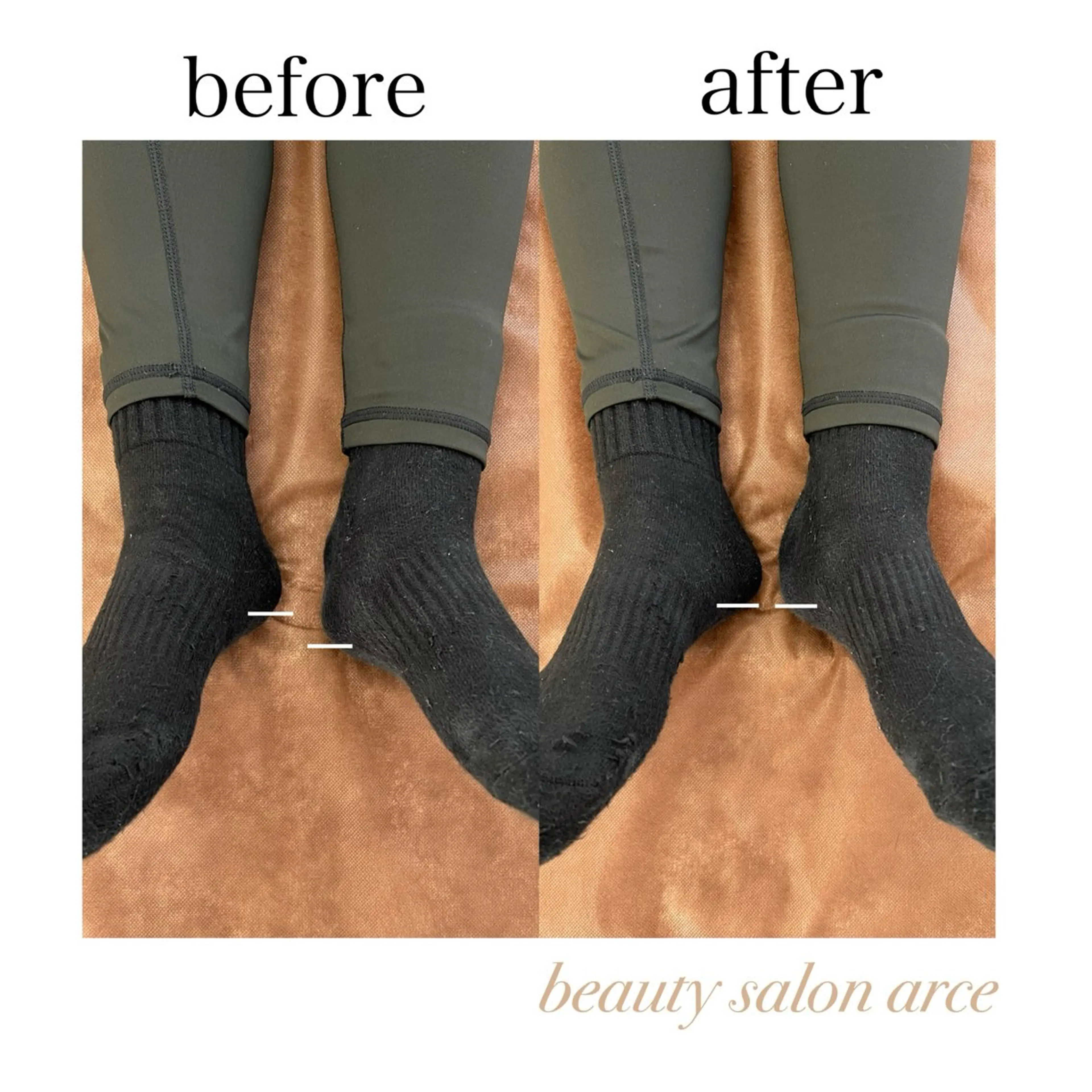 ＂今だけ半額＂【スタンダード｜骨盤矯正】骨盤の歪み＆下半身太りを根本から改善！の写真