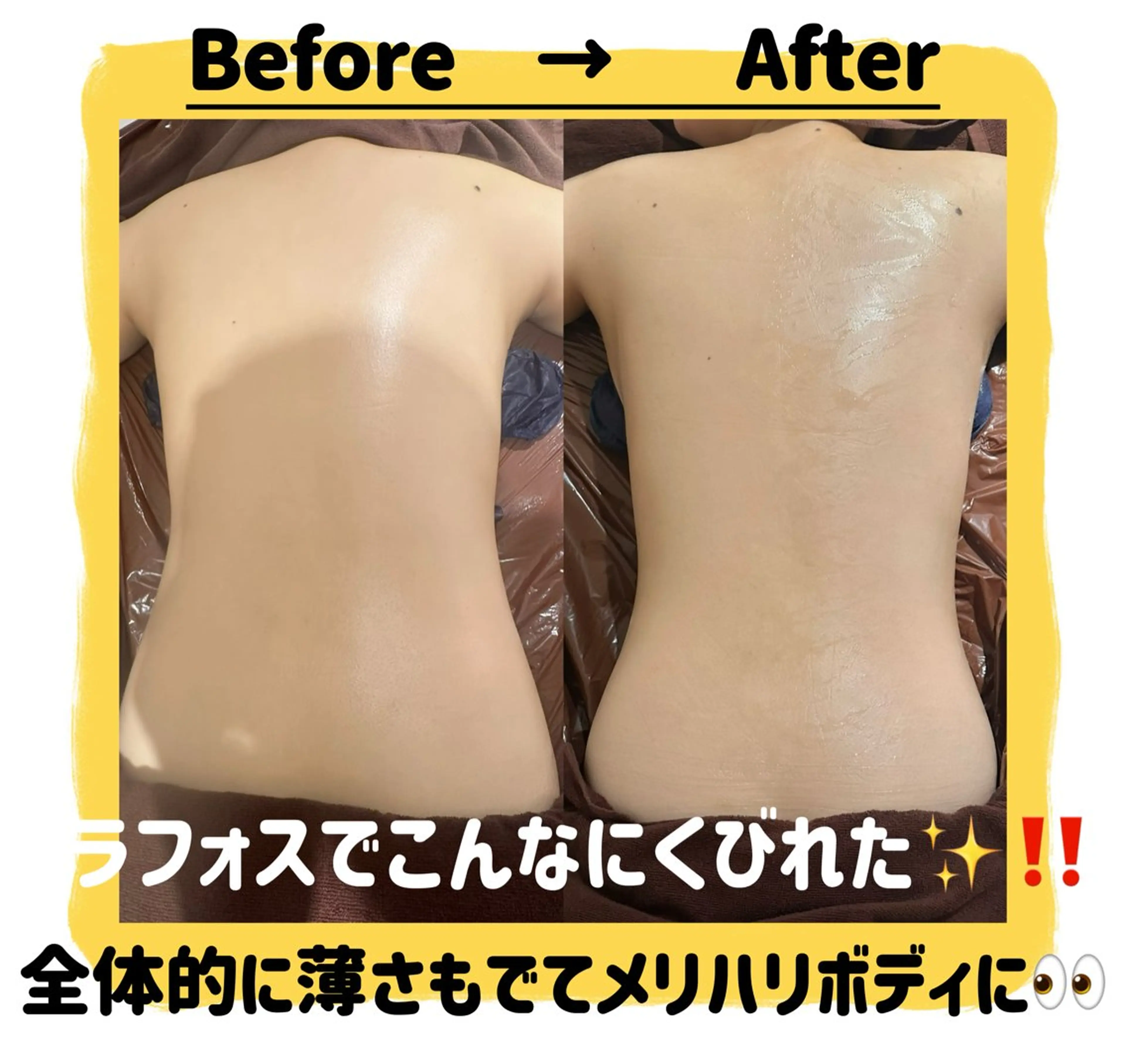 エステ パルティール🩷 shioriのエステ・リラクイメージ