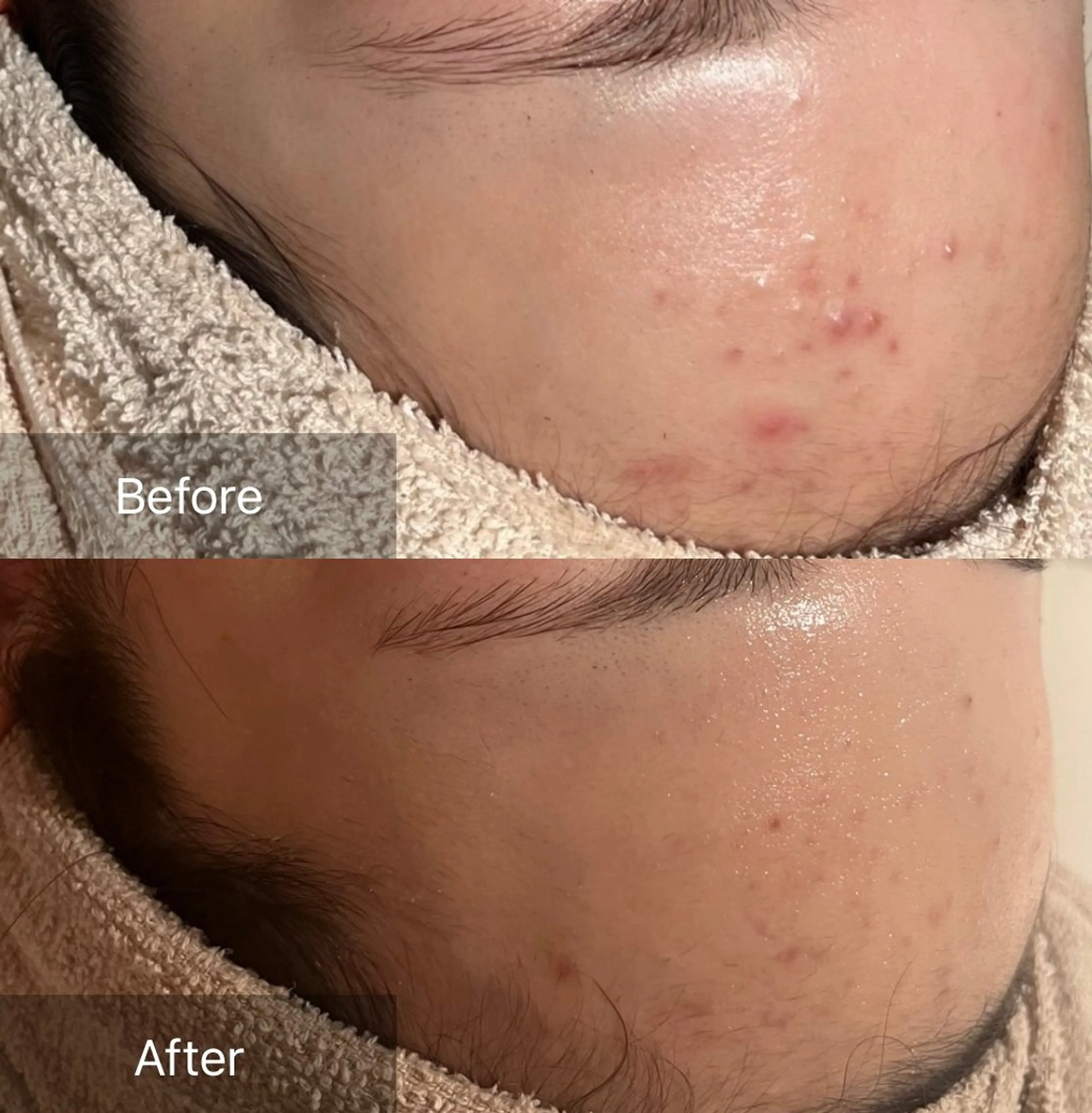 その他 for woman所属・森 美優のエステ・リラクイメージ