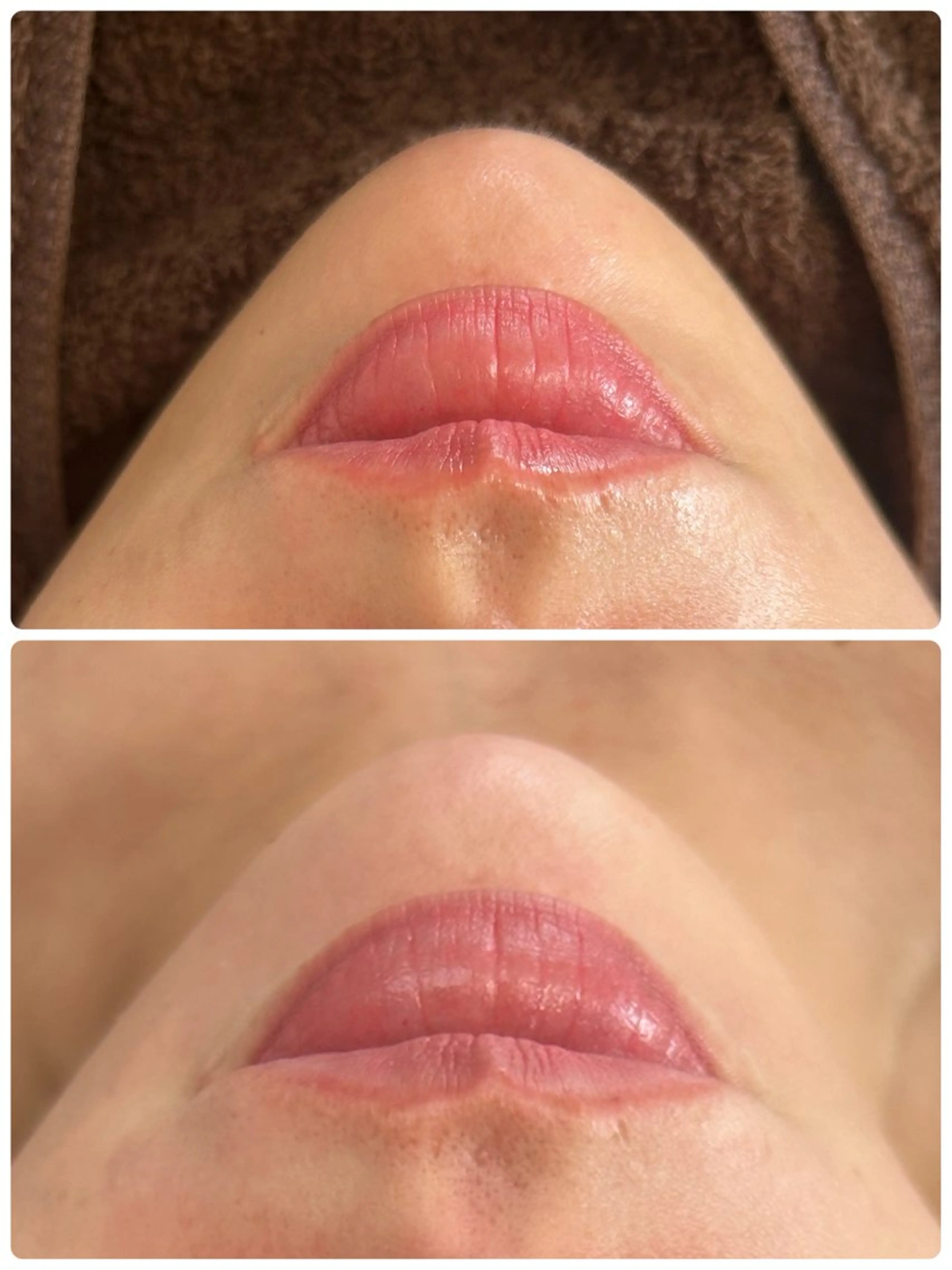 エステ beauty  salon sorelle所属・産毛角質ケア/艶肌 フェイシャルワックスのエステ・リラクイメージ