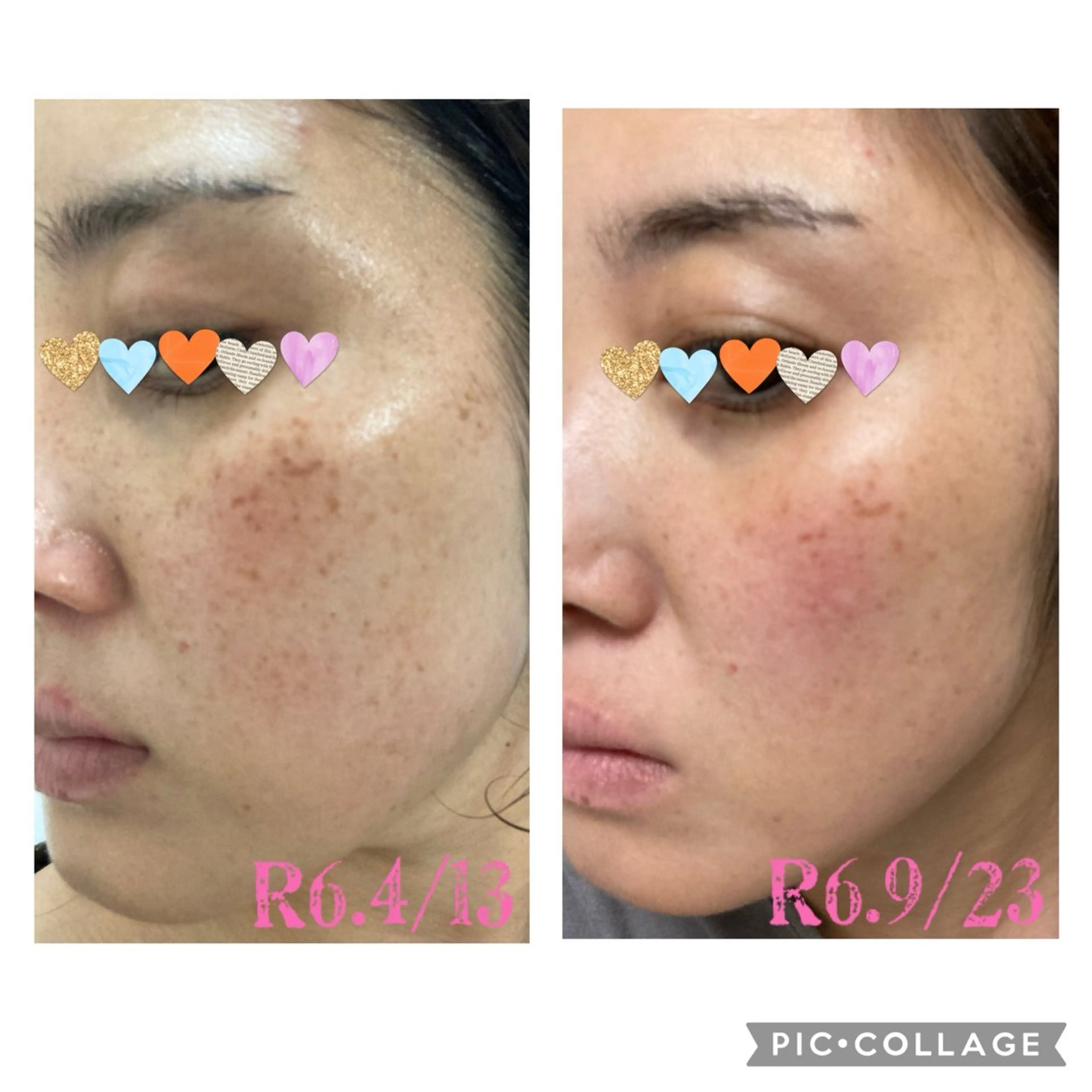 ECLAT エクラ所属・寺山 千鶴のネイルデザイン