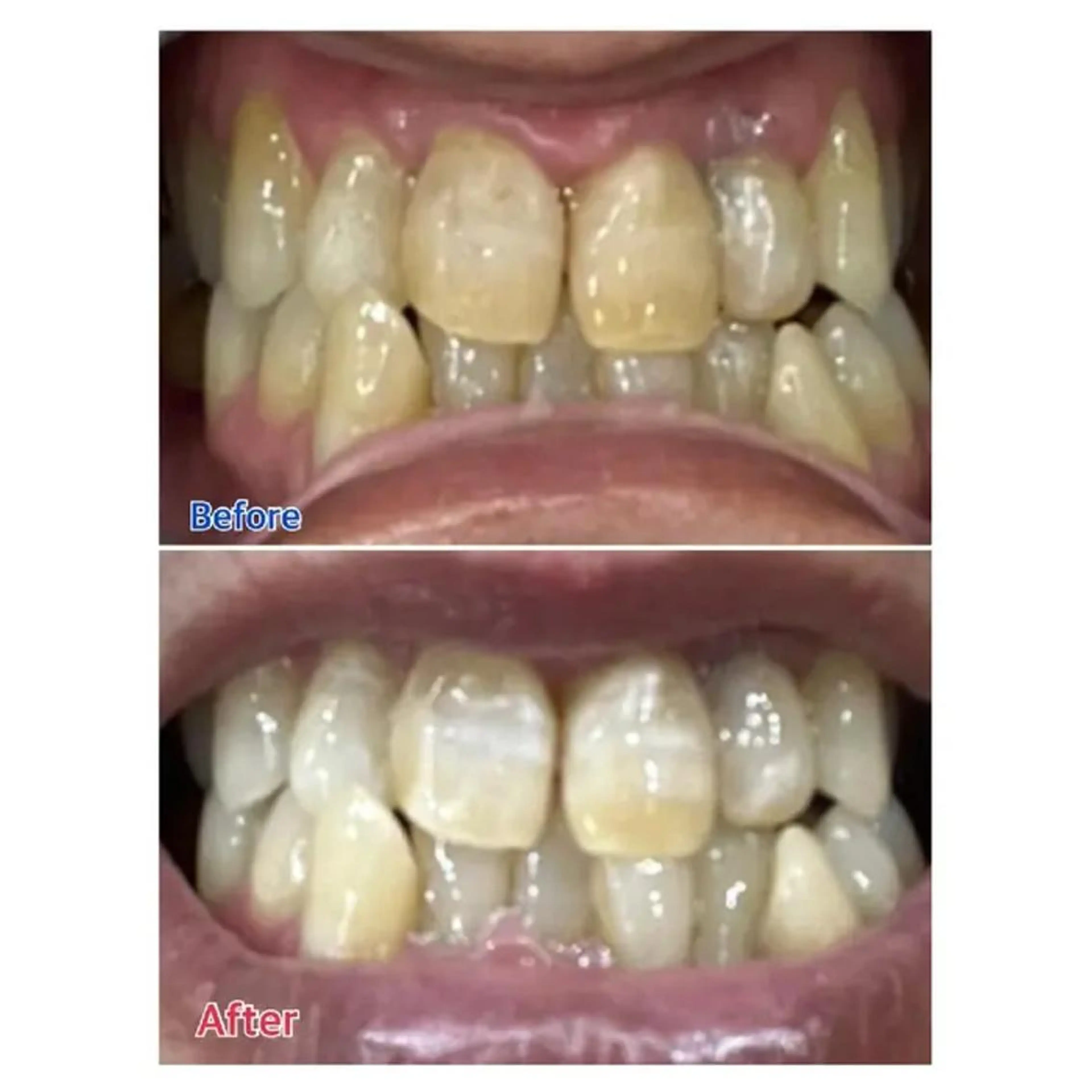 M渋谷 ホワイトニングのその他イメージ