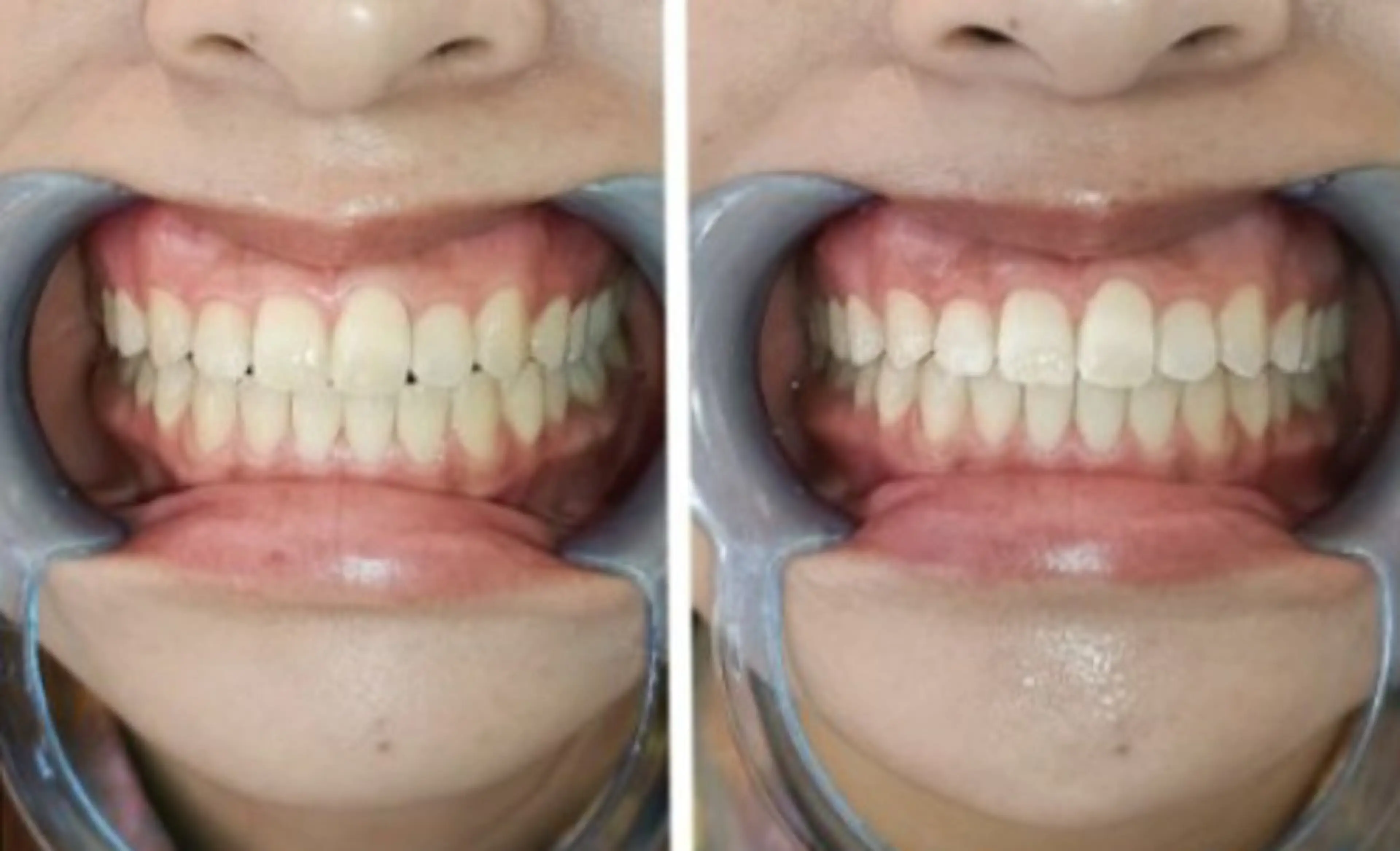 A-family  kaoriのエステ・リラクイメージ