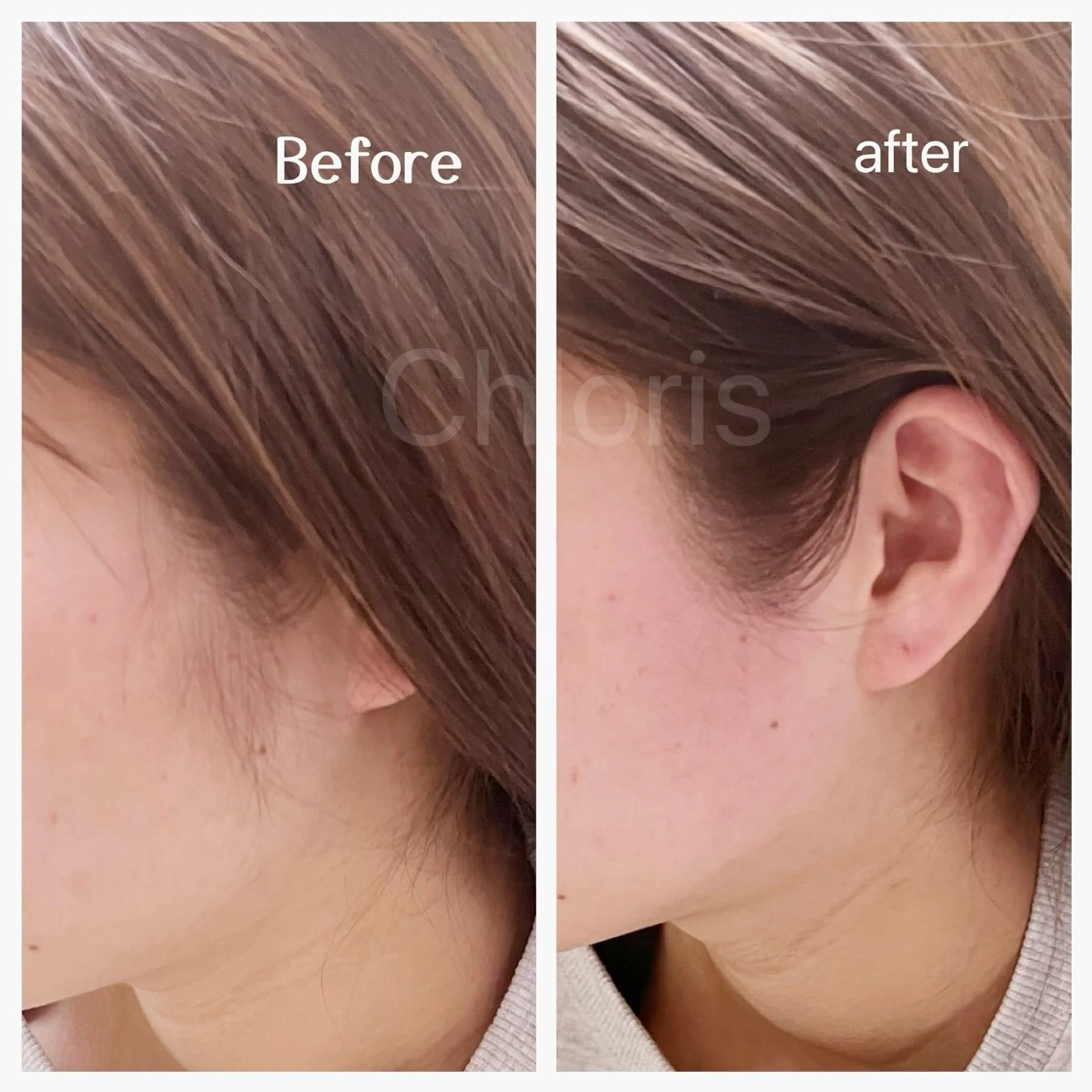 川越デリケートゾーン 光脱毛/ワックス脱毛のエステ・リラクイメージ