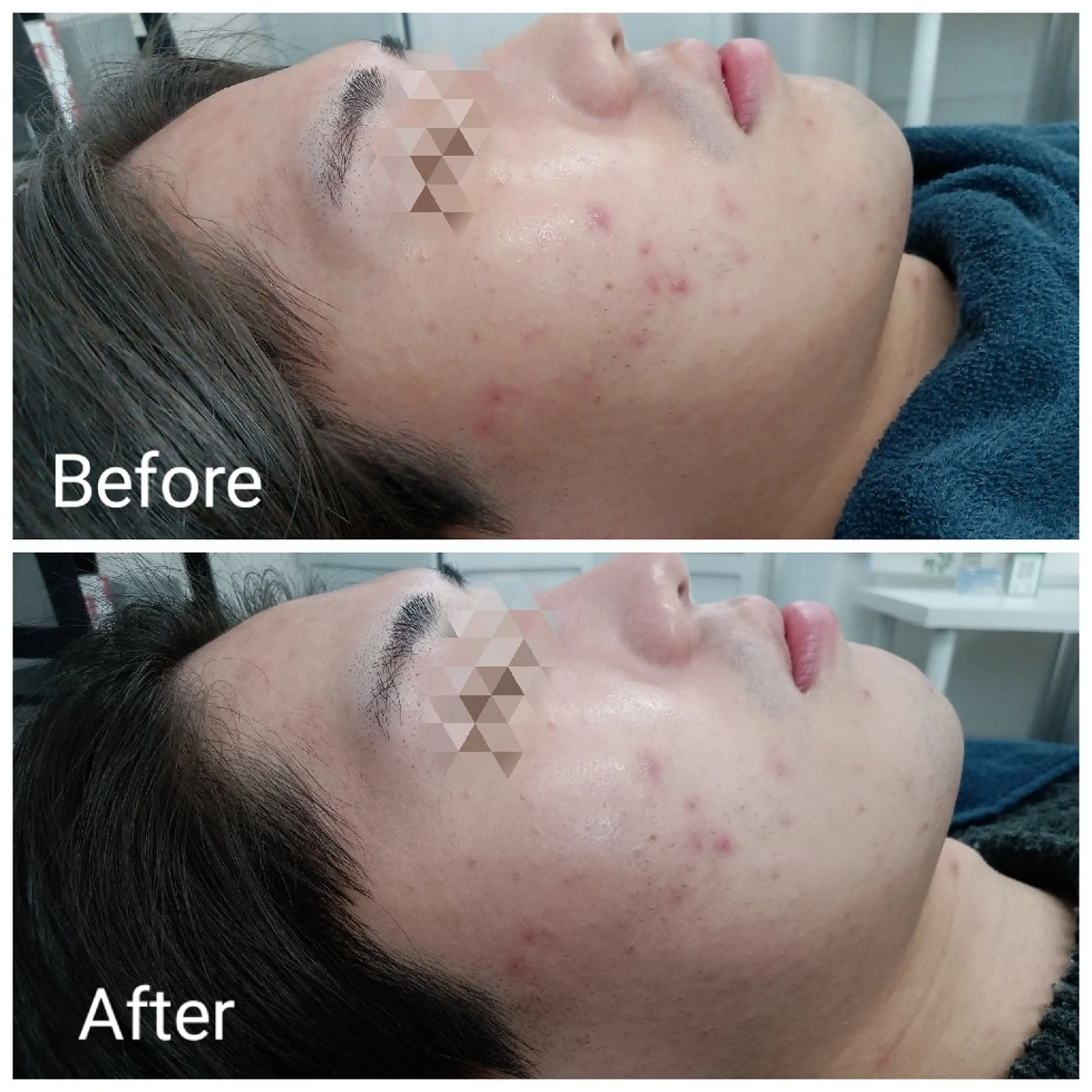 メンズ エステ リラク 肌質改善Beauty salon Renのエステ・リラクイメージ