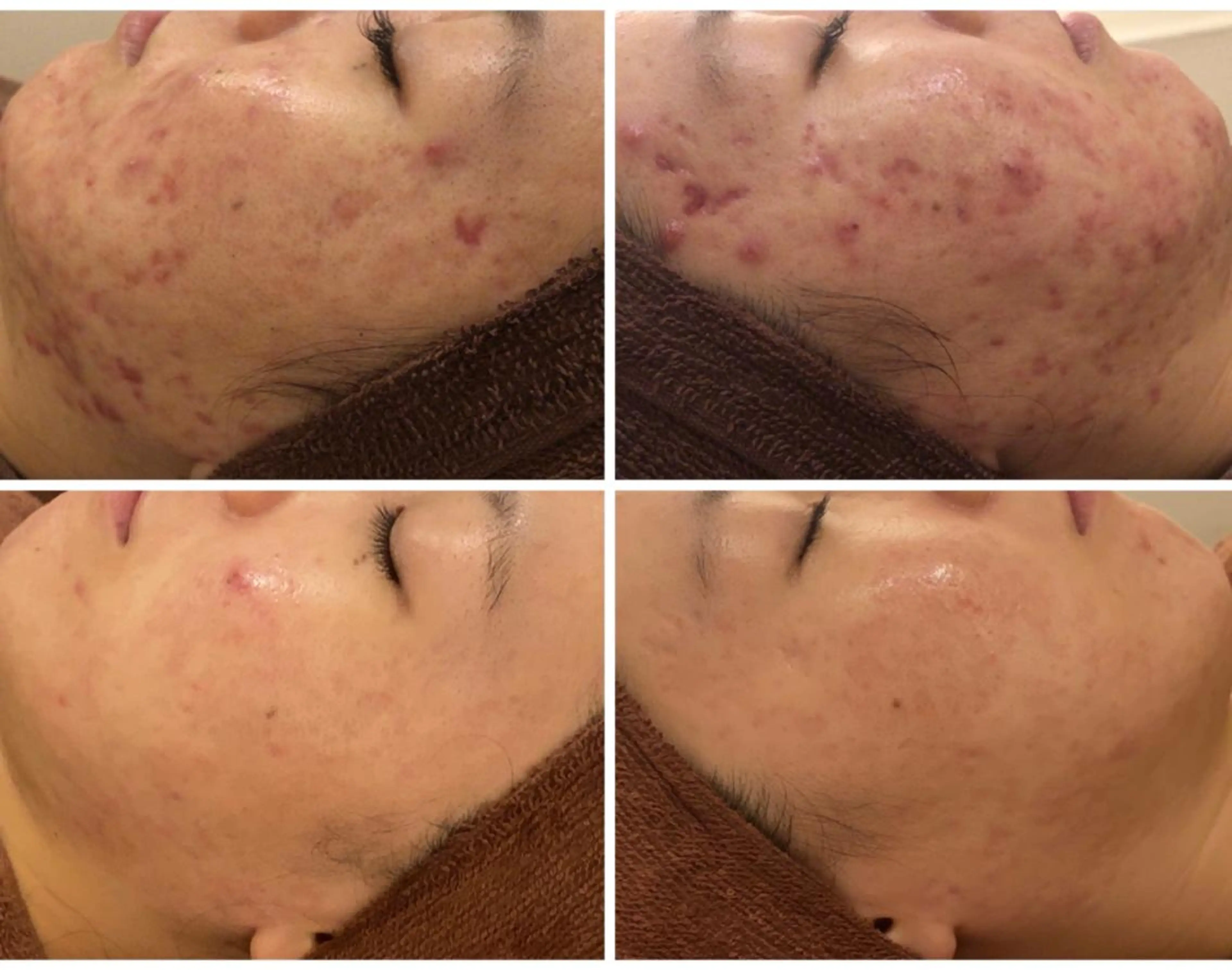 ショート カラー パーマ ヘアアレンジ メンズ キッズ ネイル マツエク・マツパ エステ リラク ニキビ・肌質改善専門 ♡人生が変わるサロンのエステ・リラクイメージ