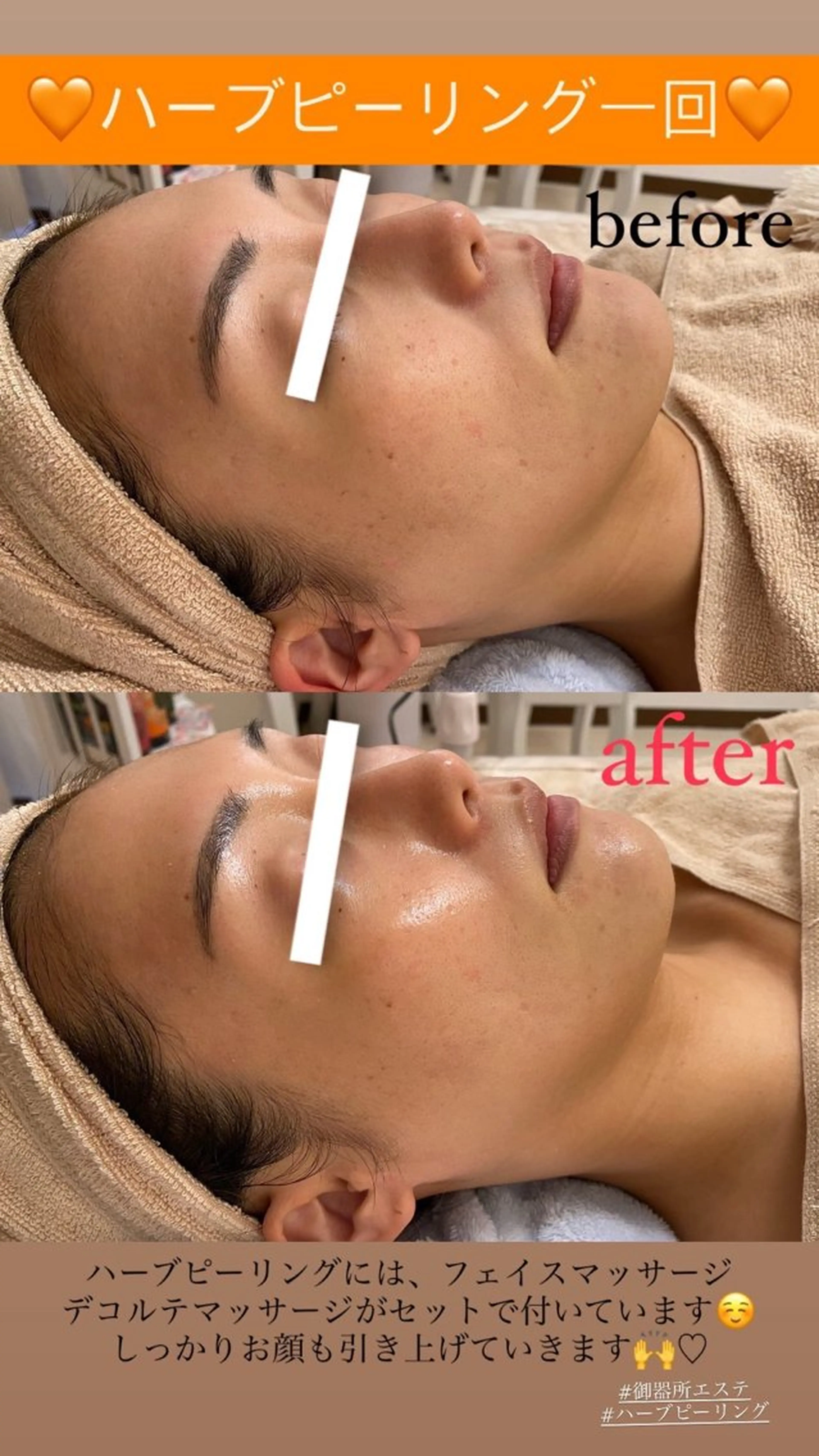 エステ Salon de Lino 御器所のエステ・リラクイメージ