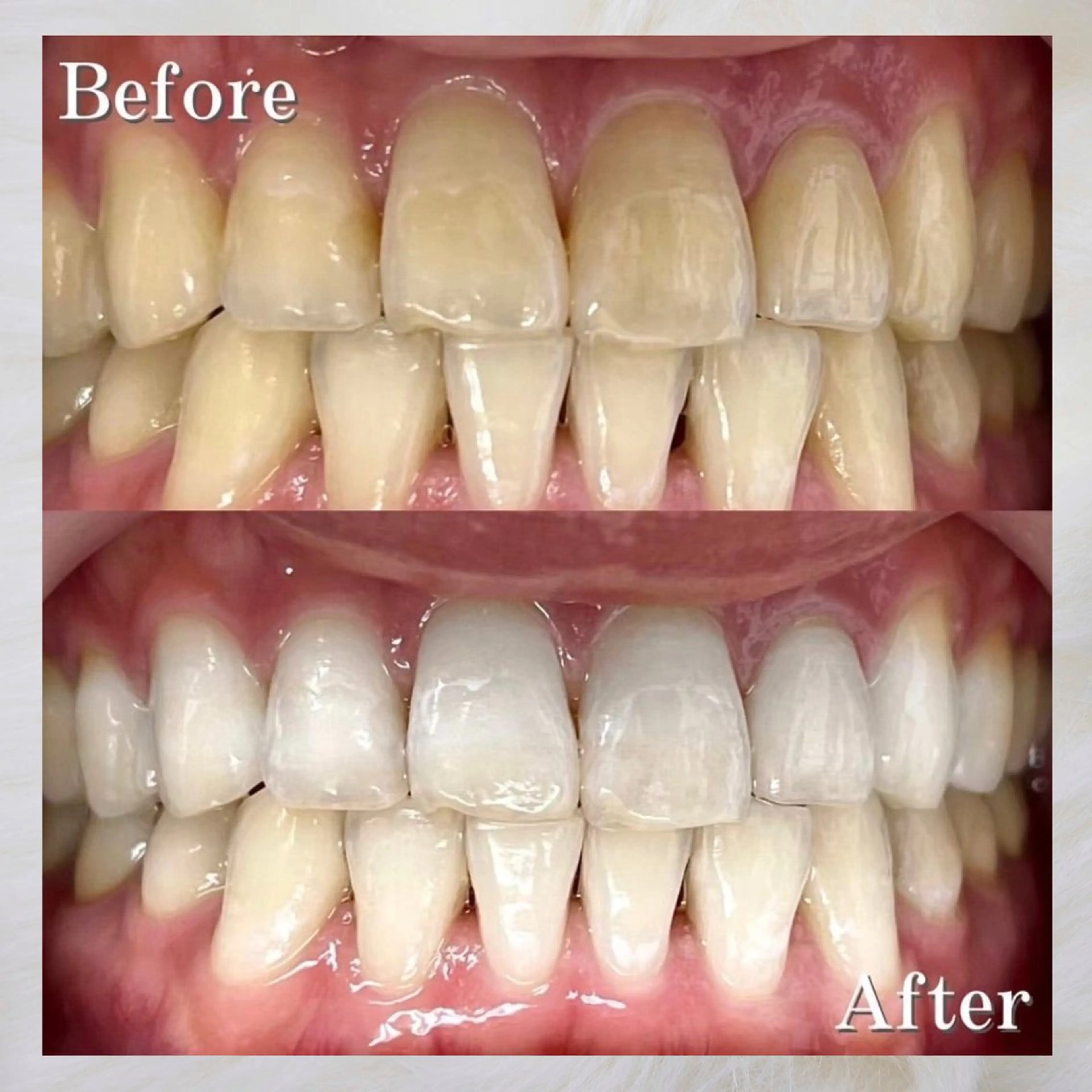 LBSホワイトニング 🌐岡山店のその他イメージ